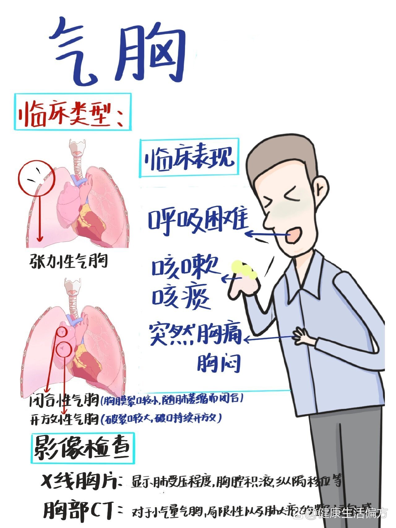 医学生笔记|气胸