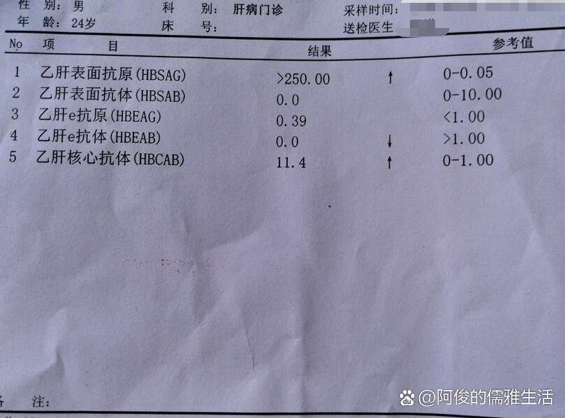 正常乙肝五项标准值图片