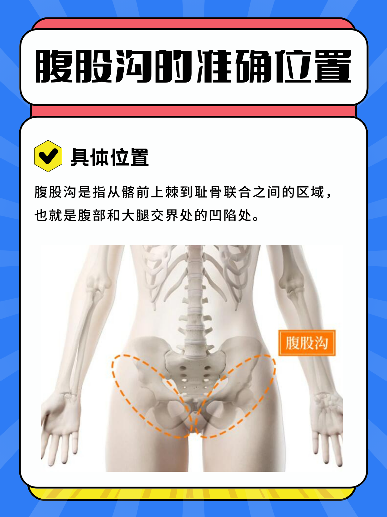 女性腹股沟具体位置图片