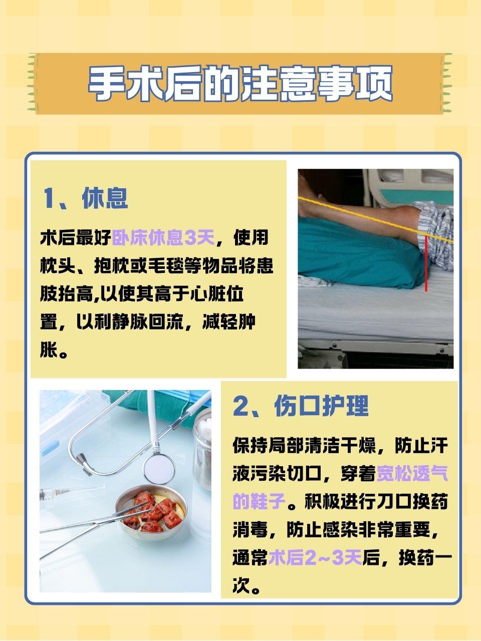 去大脚骨手术多少钱?一文解析!