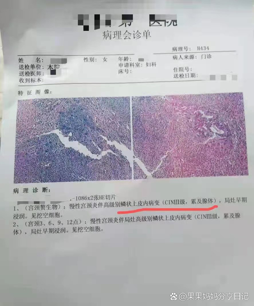 宫颈癌前病变一定要手术治疗吗?