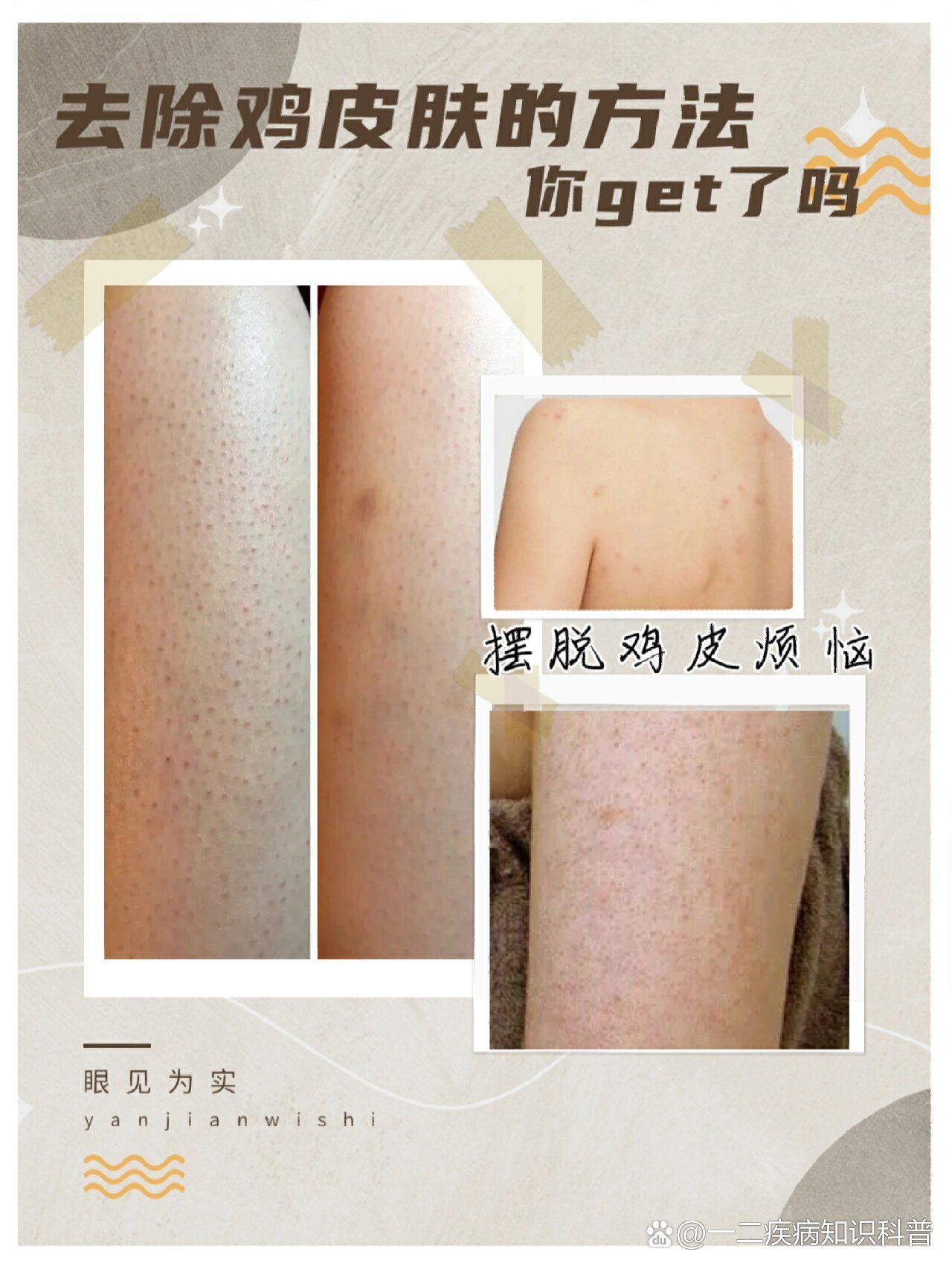 去除鸡皮肤的方法你get了吗?