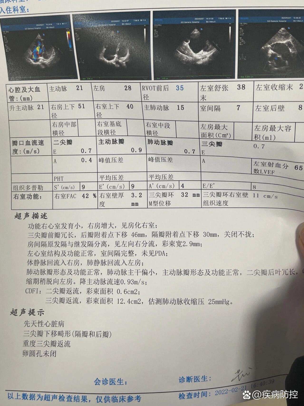 心脏病能活多久图片