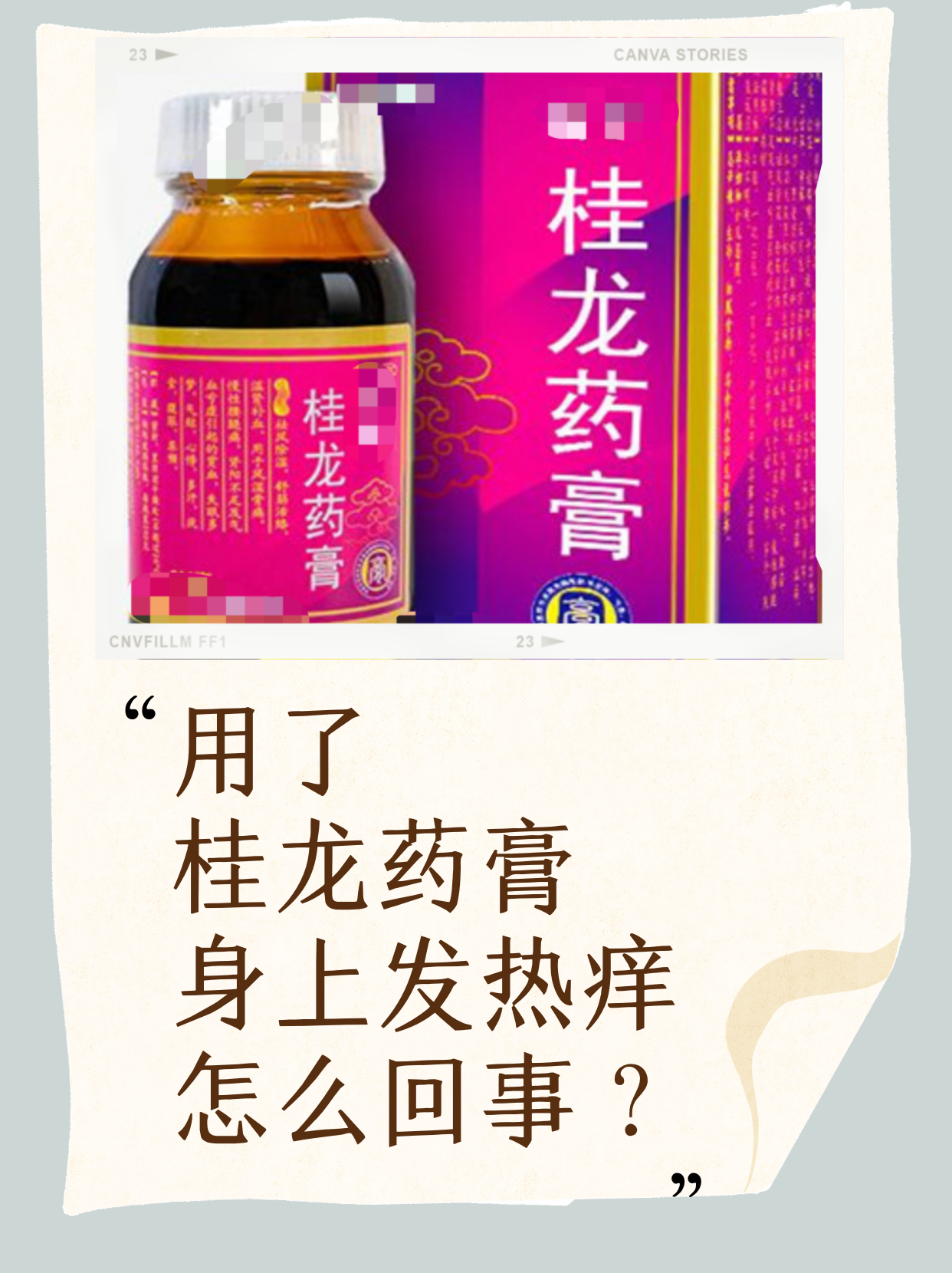 涨知识!用了桂龙药膏身上发热痒怎么回事?