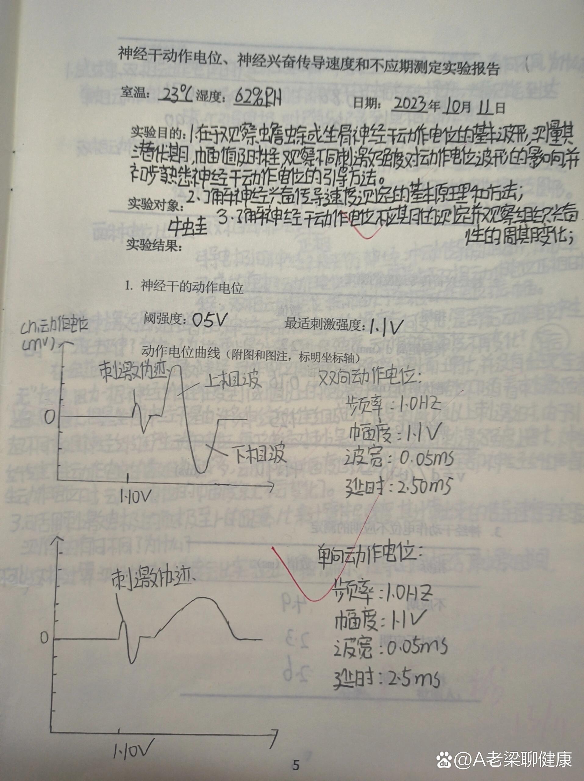 神经传导电位变化图图片