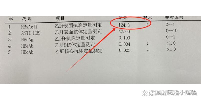 乙肝表面抗原多少正常图片