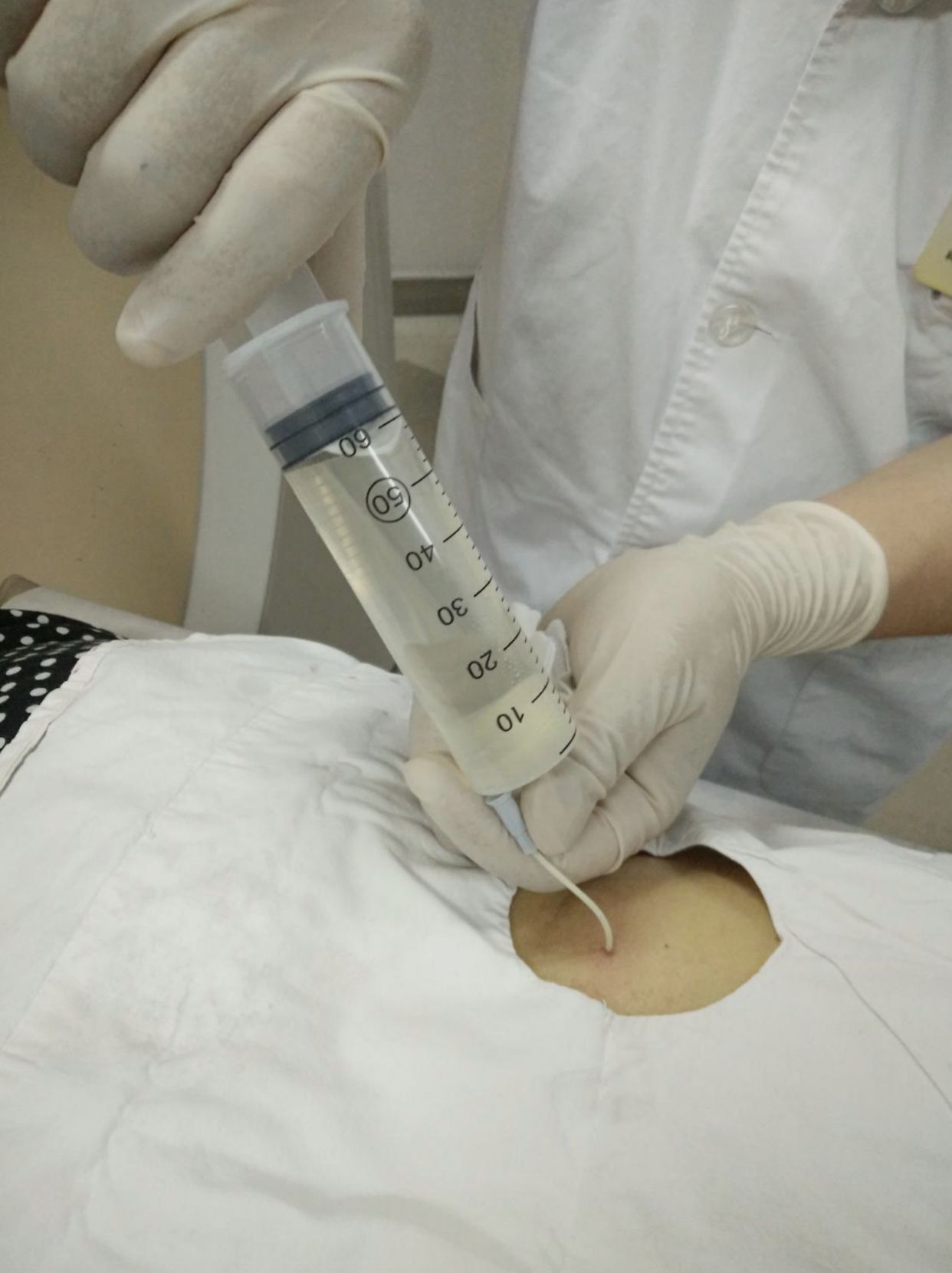 肺积水是肺里有水吗?肿么办!