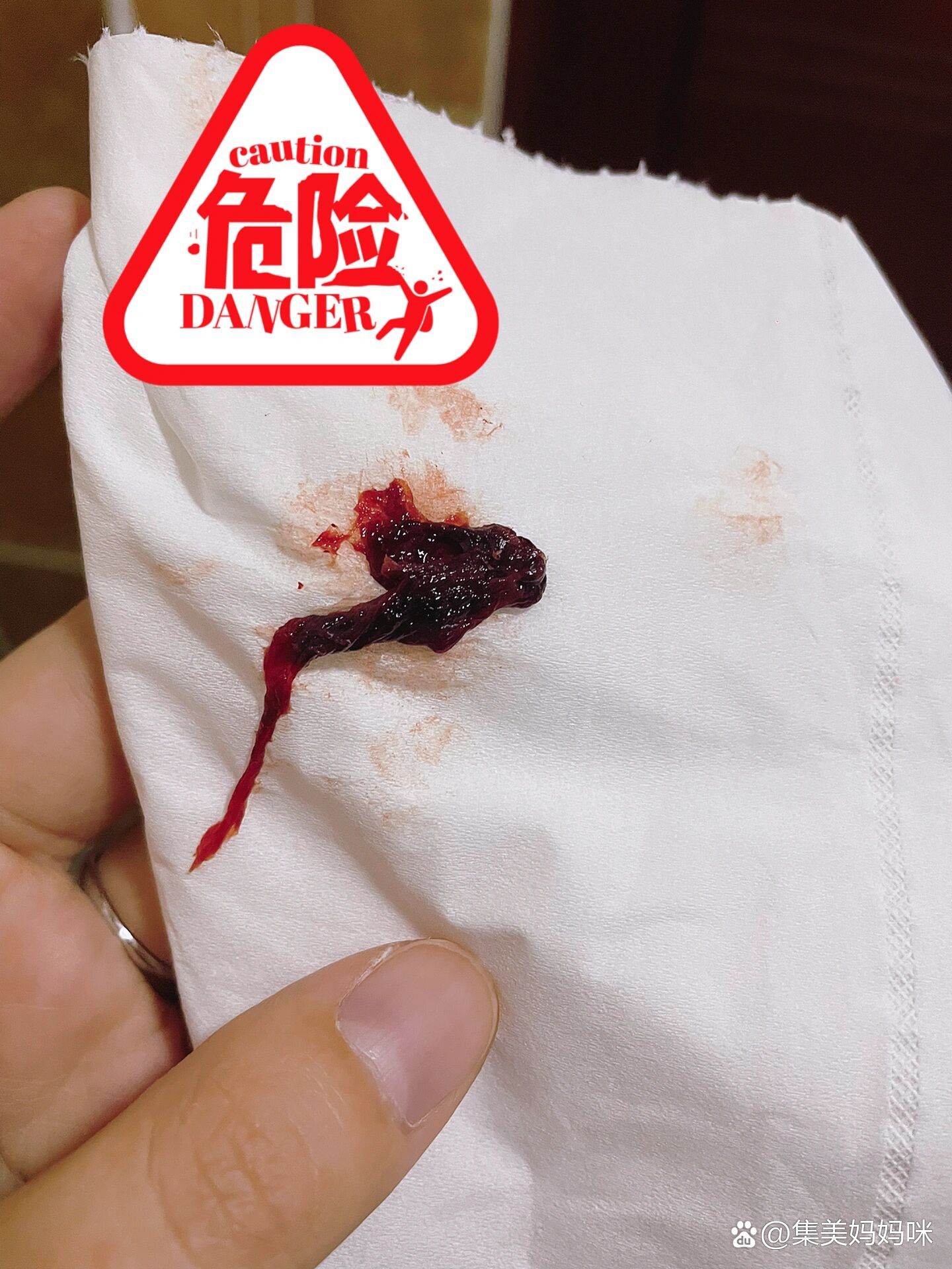 排异物血块是生化吗