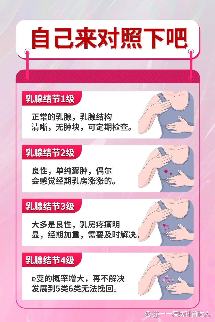 乳腺增生结节真人图片