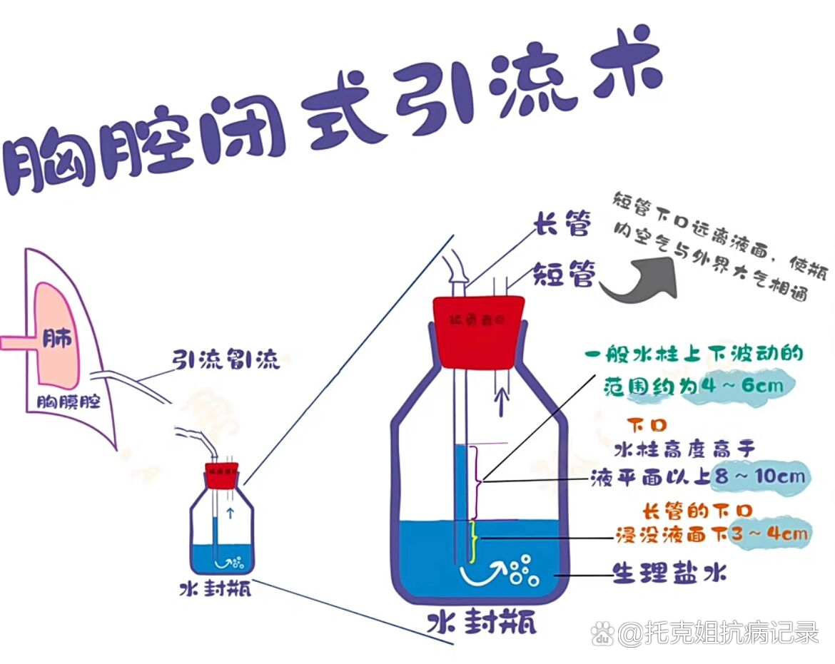 胸腔闭式引流护理方法