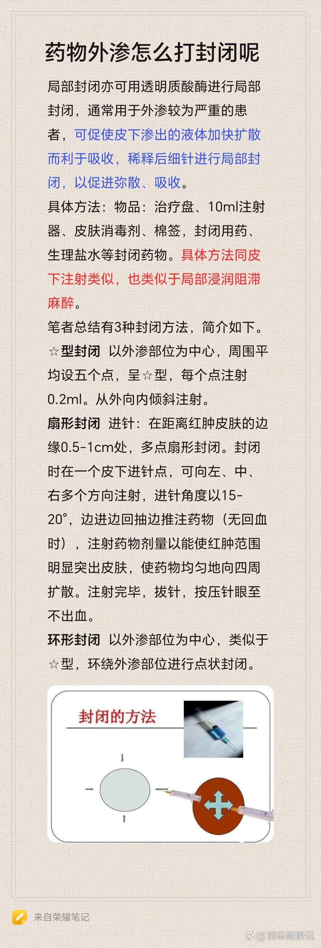 药物外渗怎么打封闭呢