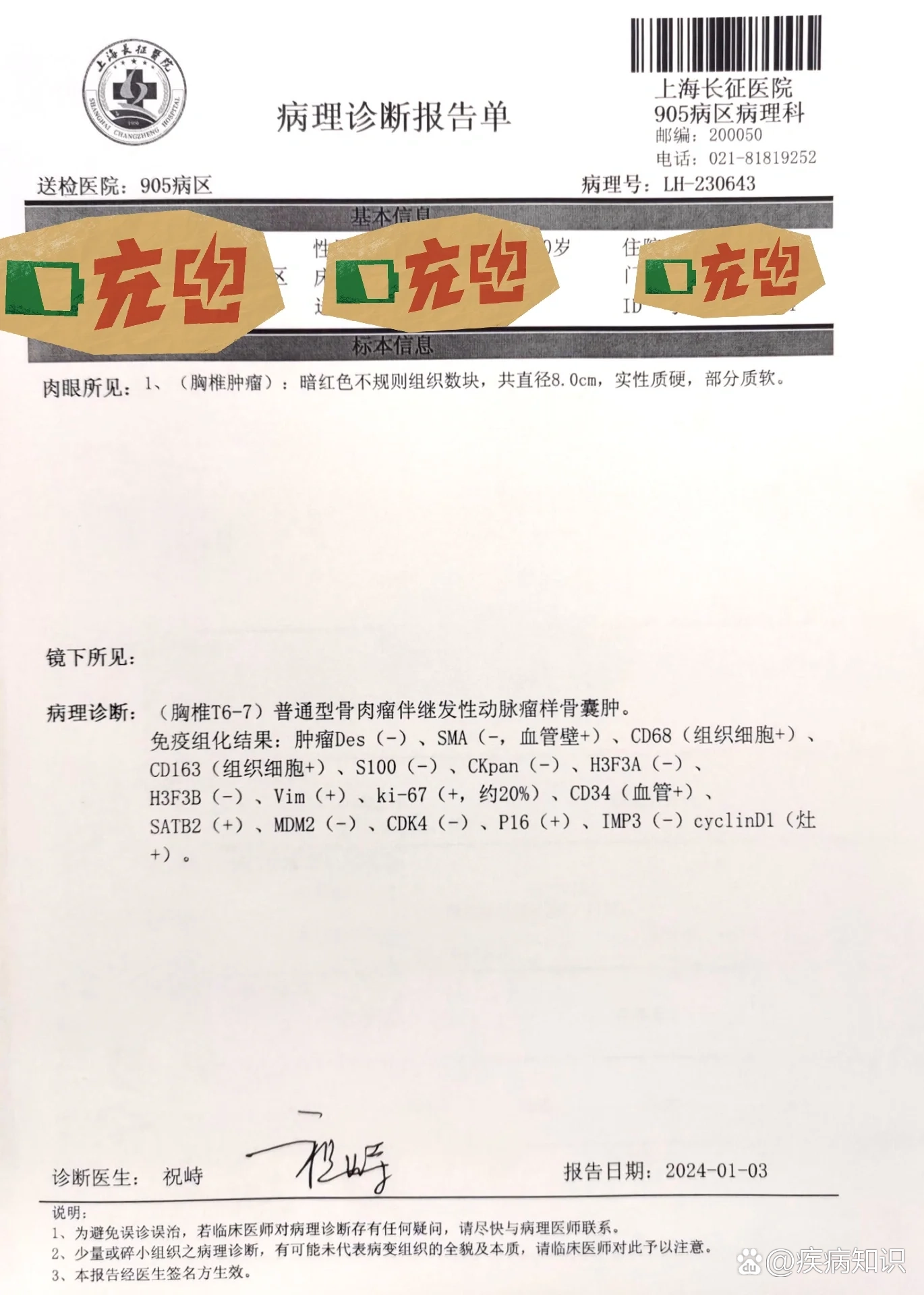 梭形细胞肿瘤