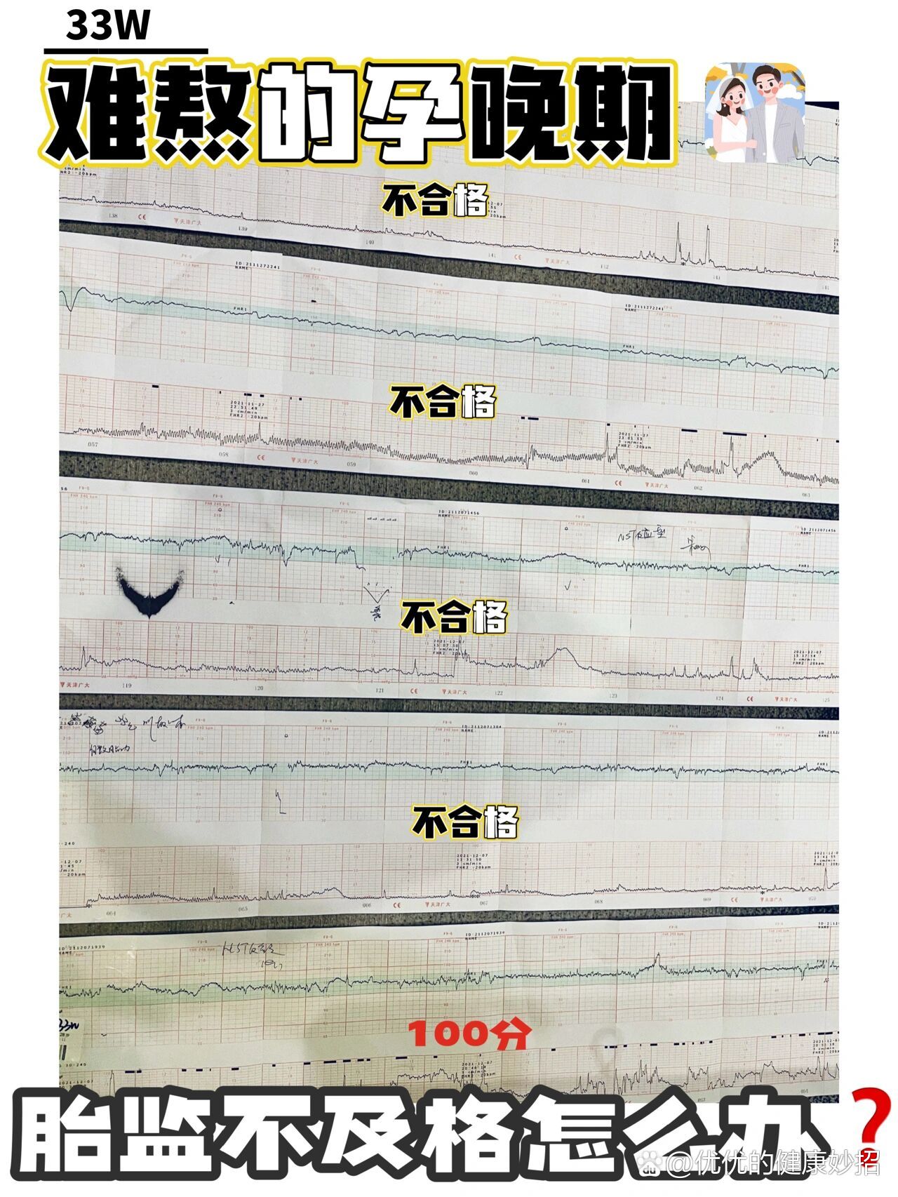 解救难熬的孕晚期|亲测有效的胎监通关秘籍