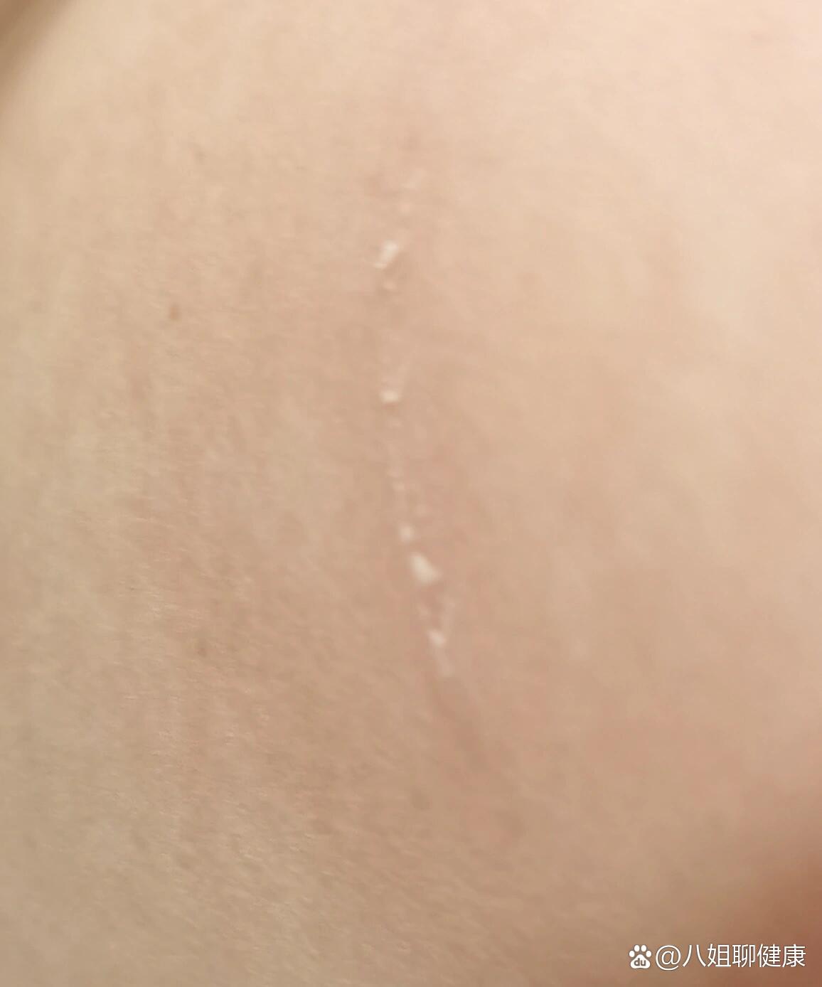 被家养柴犬牙齿划破皮