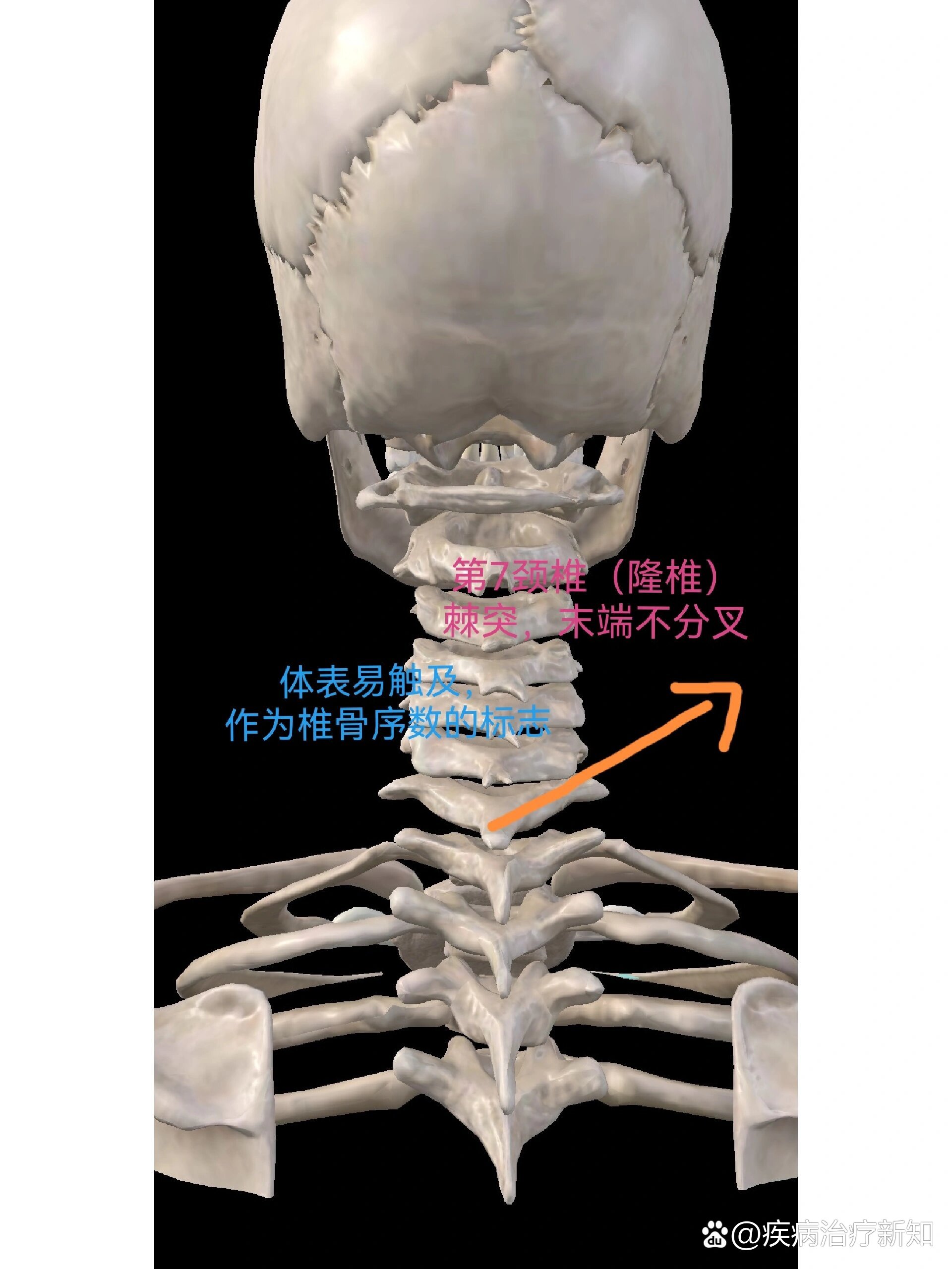 奇静脉弓下缘图片