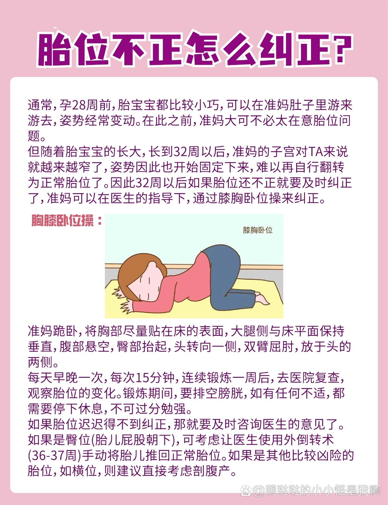 胎位不正如何调整?