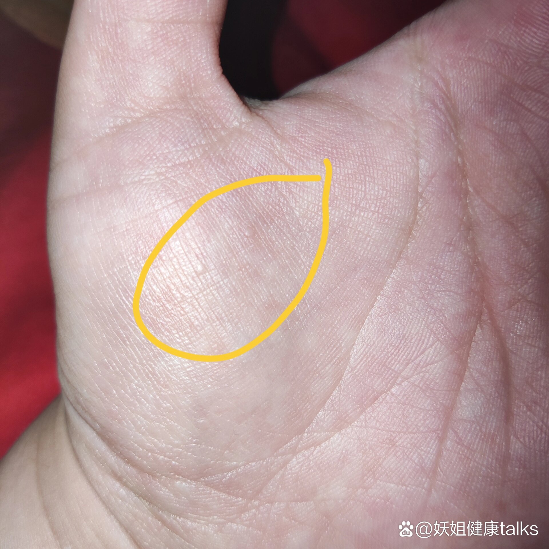 手心莫名其妙的长了几个包