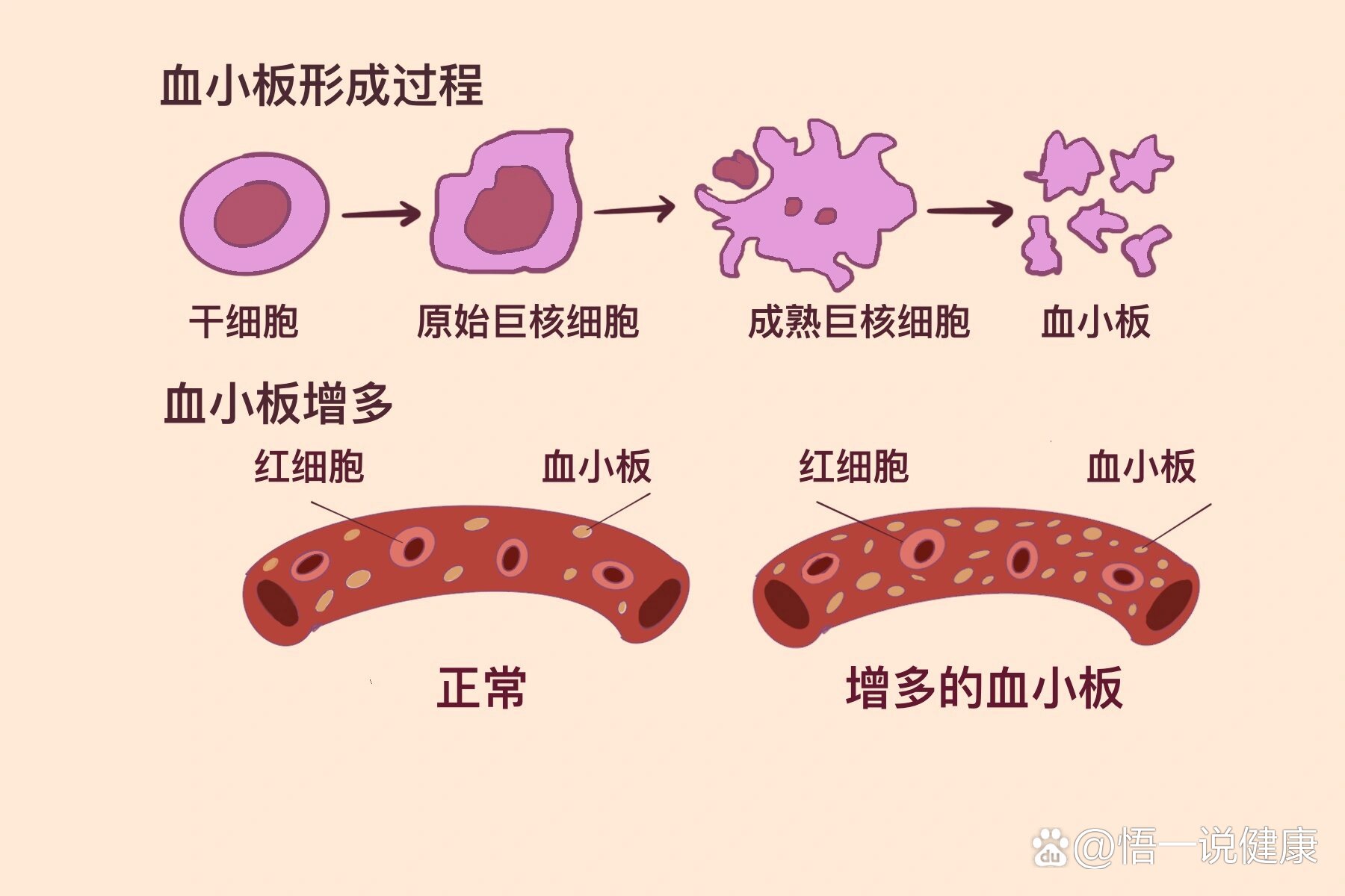 血小板聚集图解图片