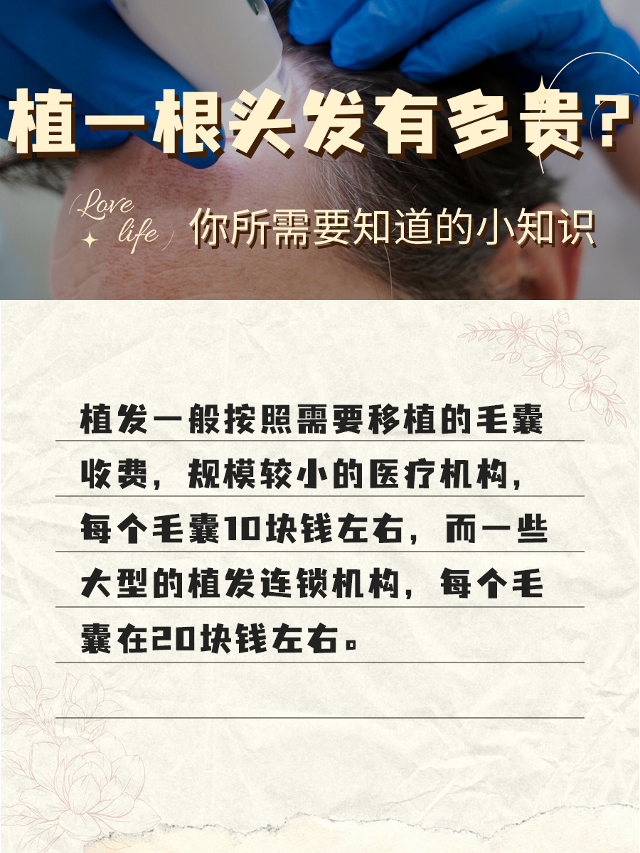 别焦虑,掉发要植真烧钱!植一根头发需要这么多钱?