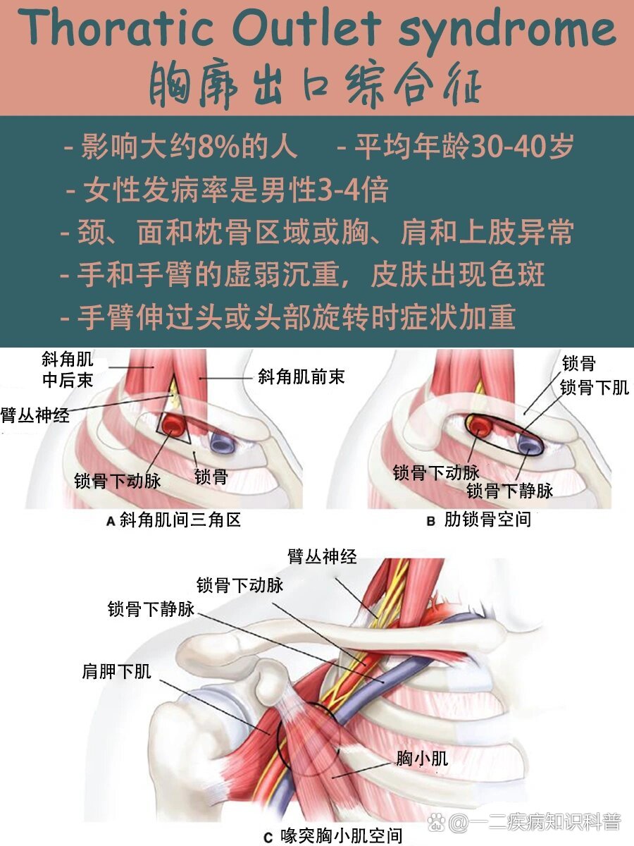 胳膊到手的详细图图片