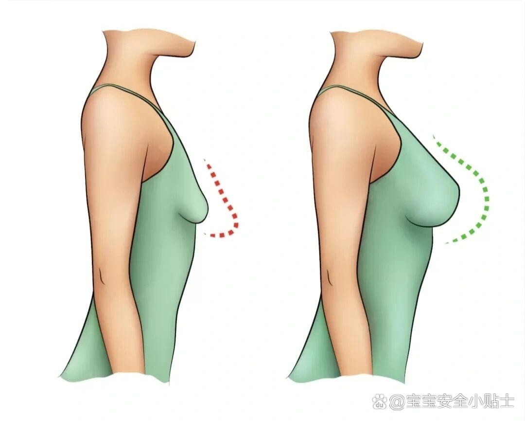 宝妈哺乳后,胸会发生什么变化?