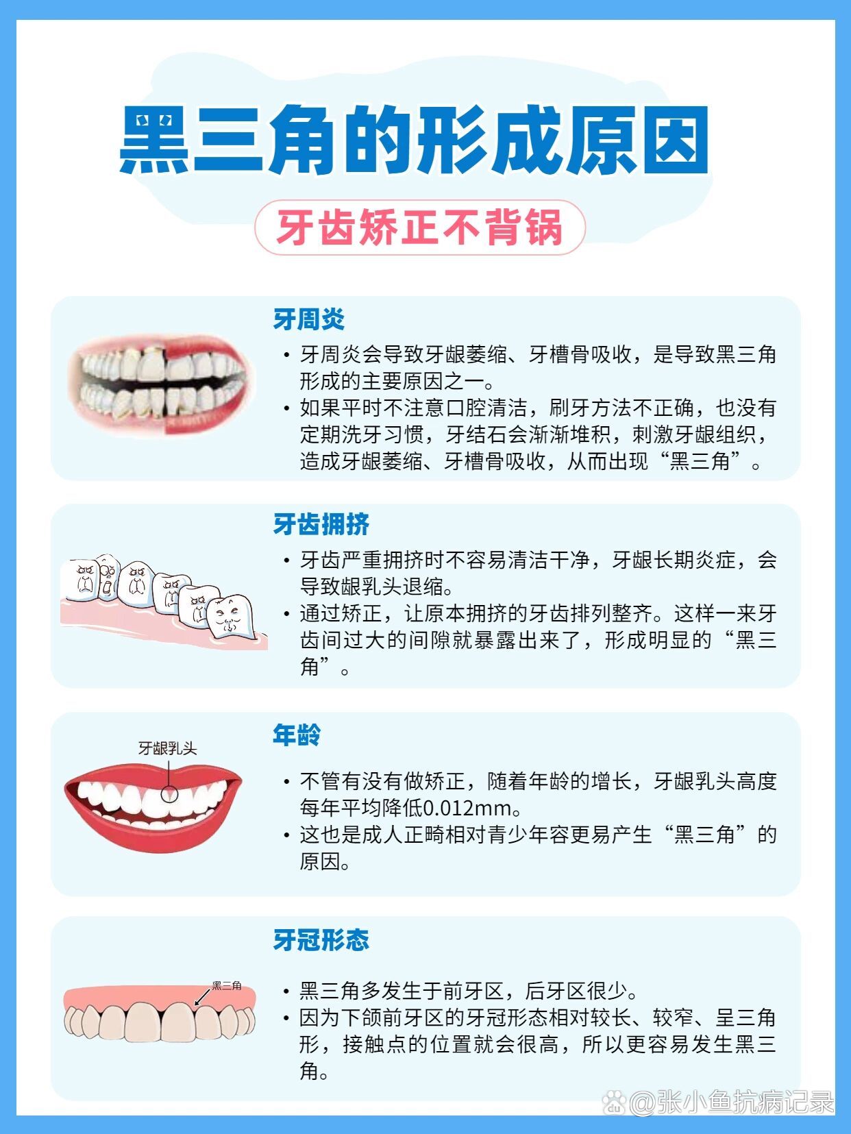 牙齿出现黑三角图片