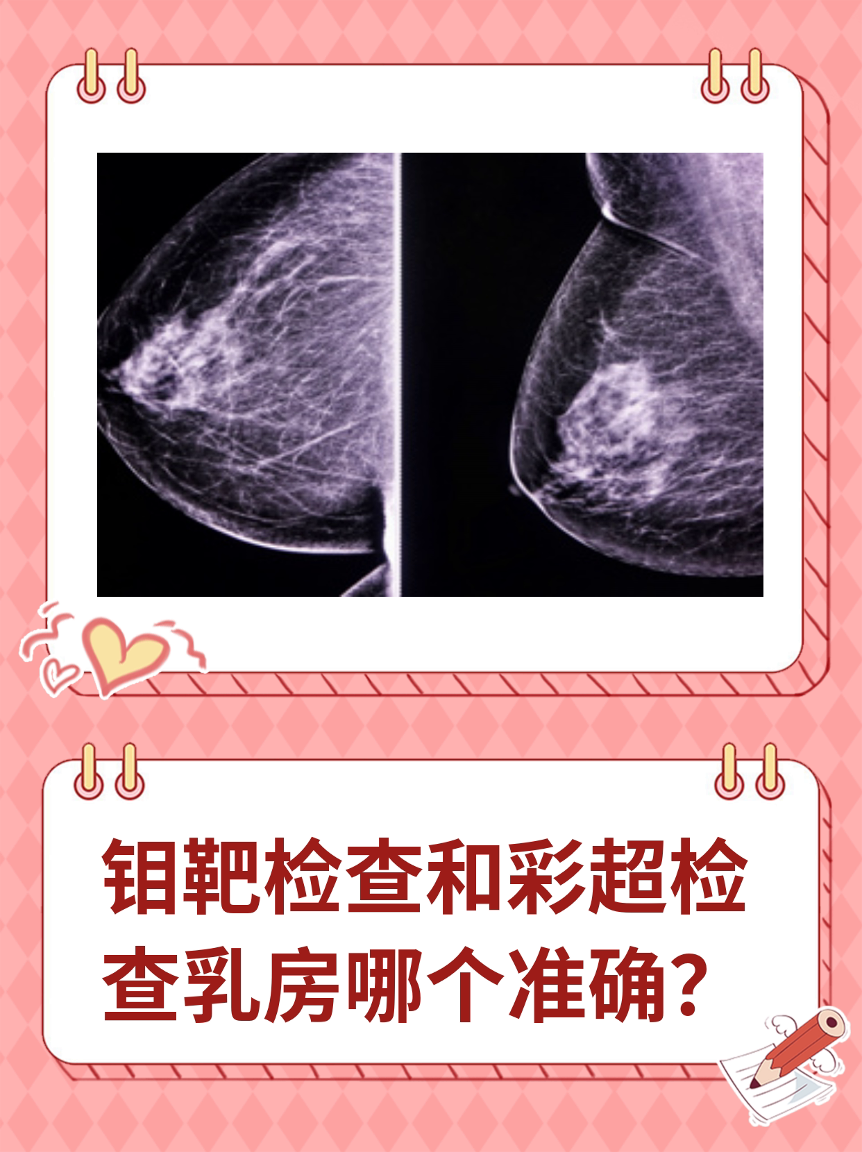 钼靶检查和彩超检查乳房哪个准确