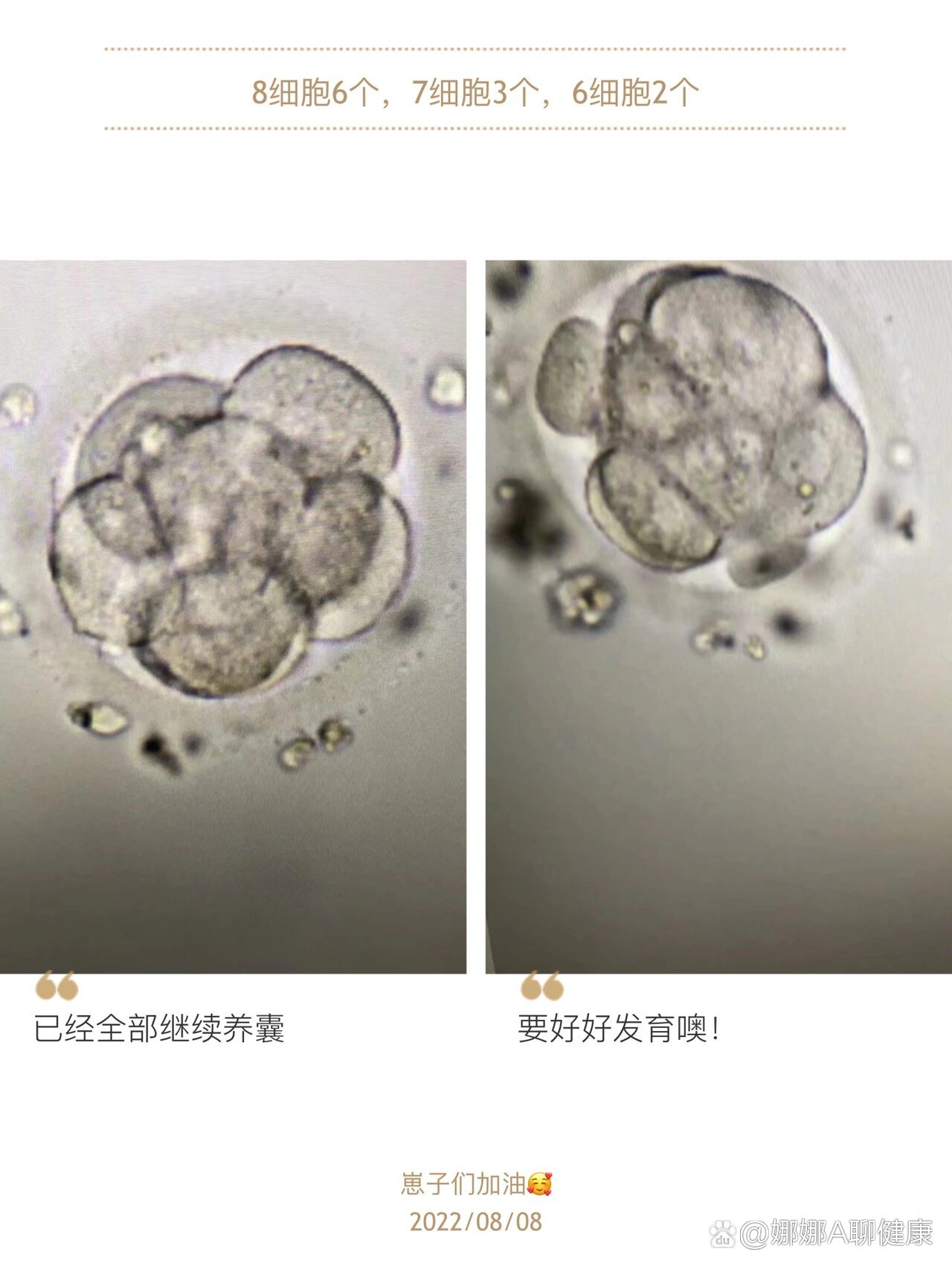 试管移植第三天胚胎图图片