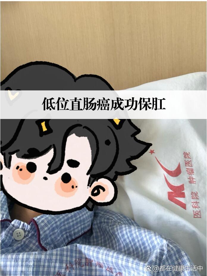 低位直肠癌成功保肛