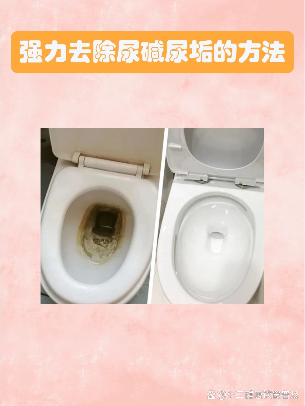 强力去除马桶尿碱尿垢的方法