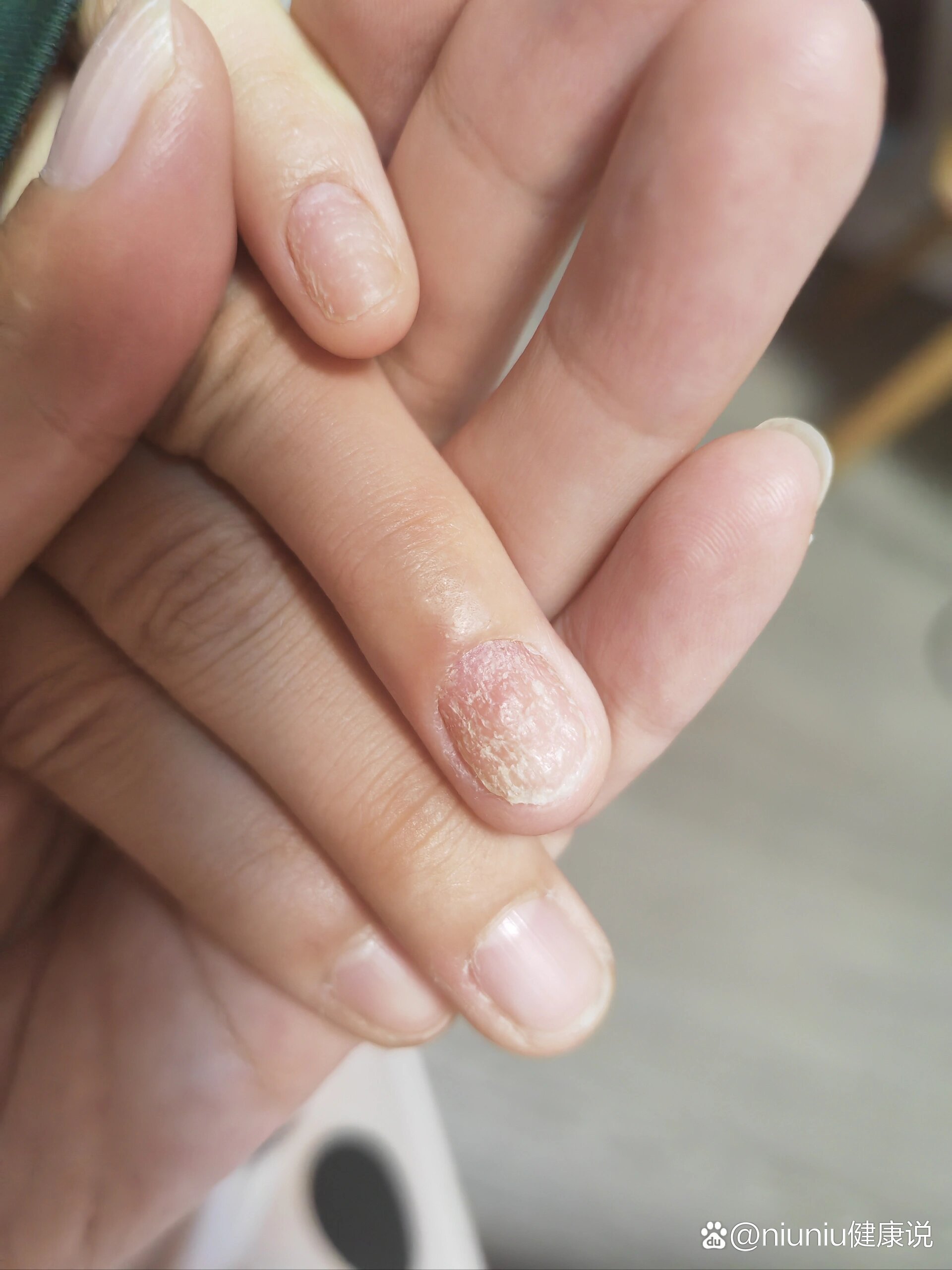 宝宝指甲长成这样了?