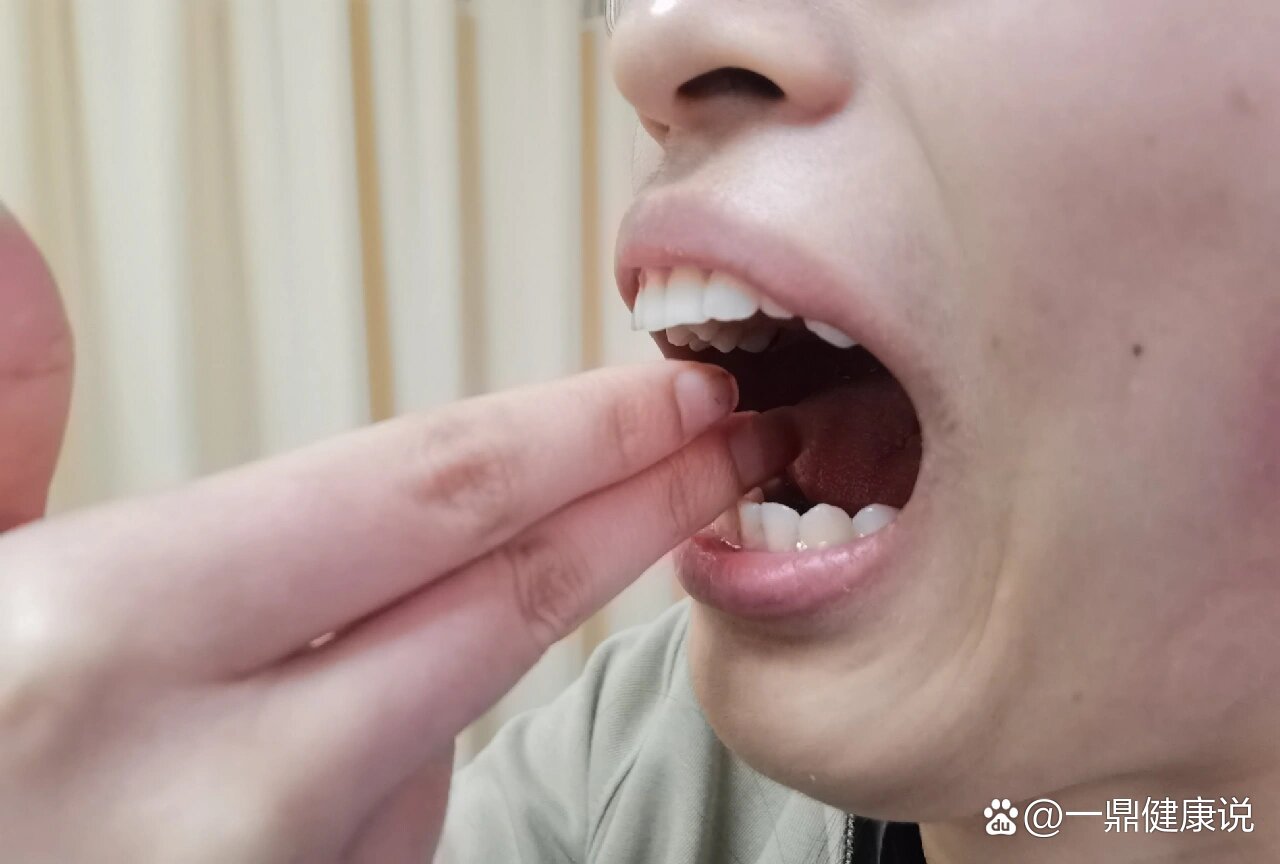  br>许多朋友不清楚如何测量张口度,今天我们就来说个简单的方法:用