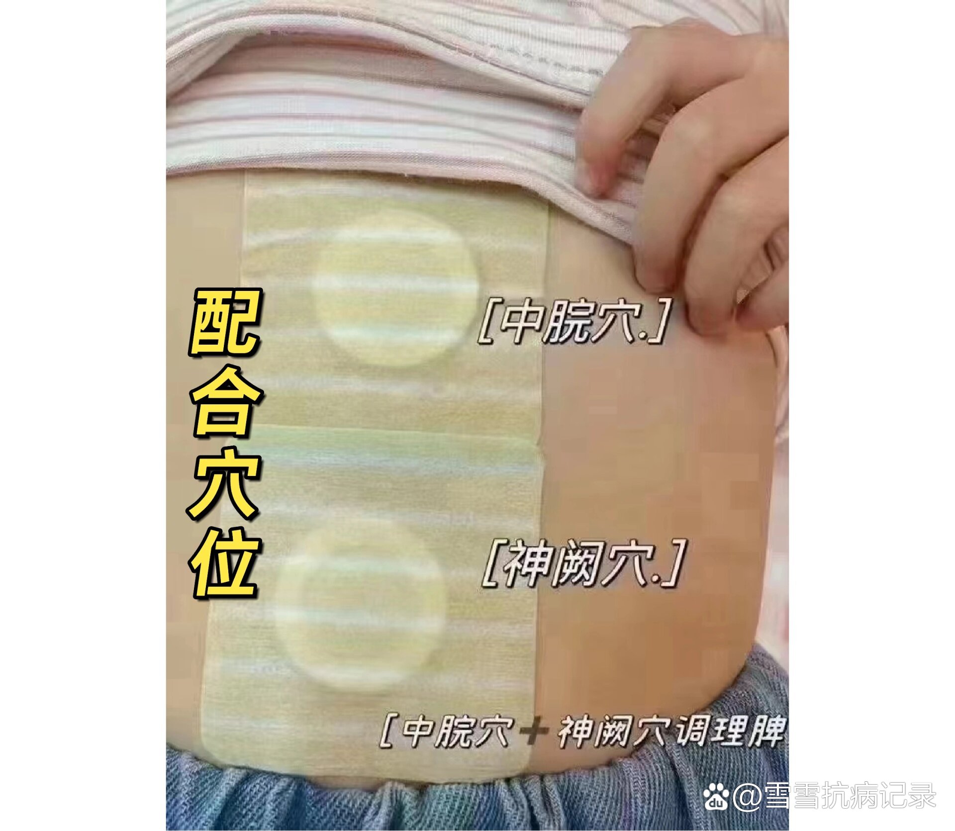 小儿脾胃贴