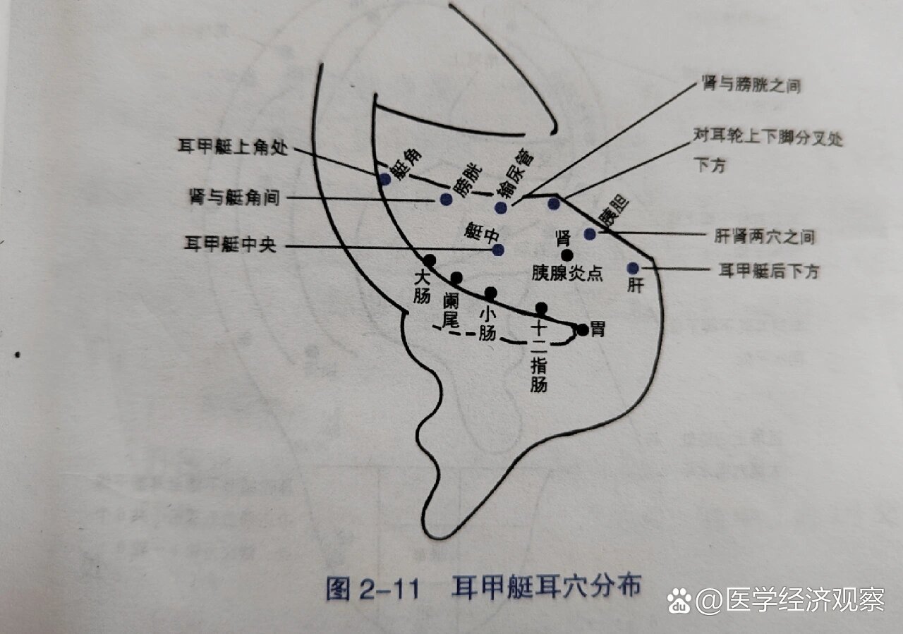 中医【耳穴定位】疗法:耳甲艇穴位分布展示