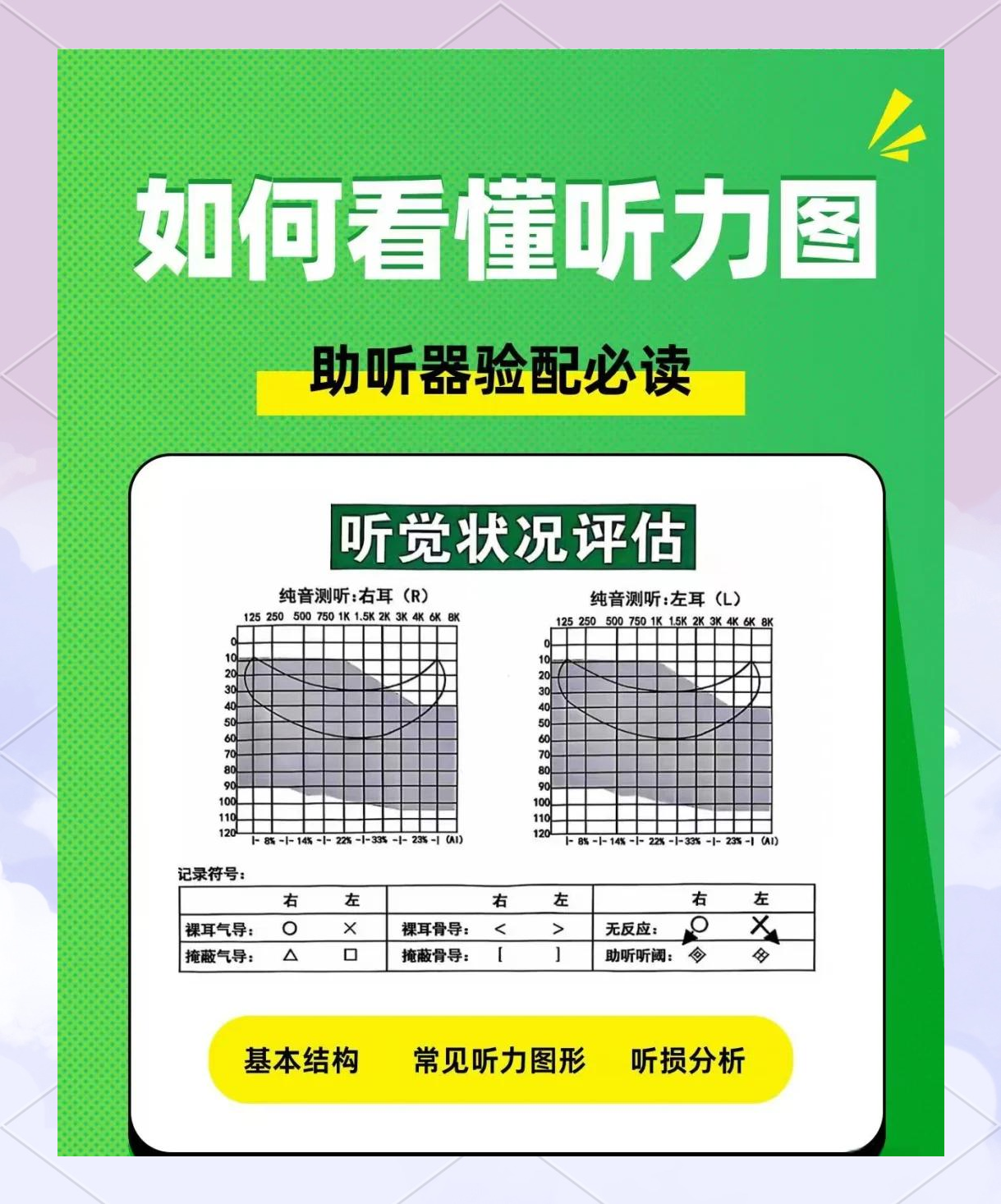 看懂听力图：这些曲线你得留意！