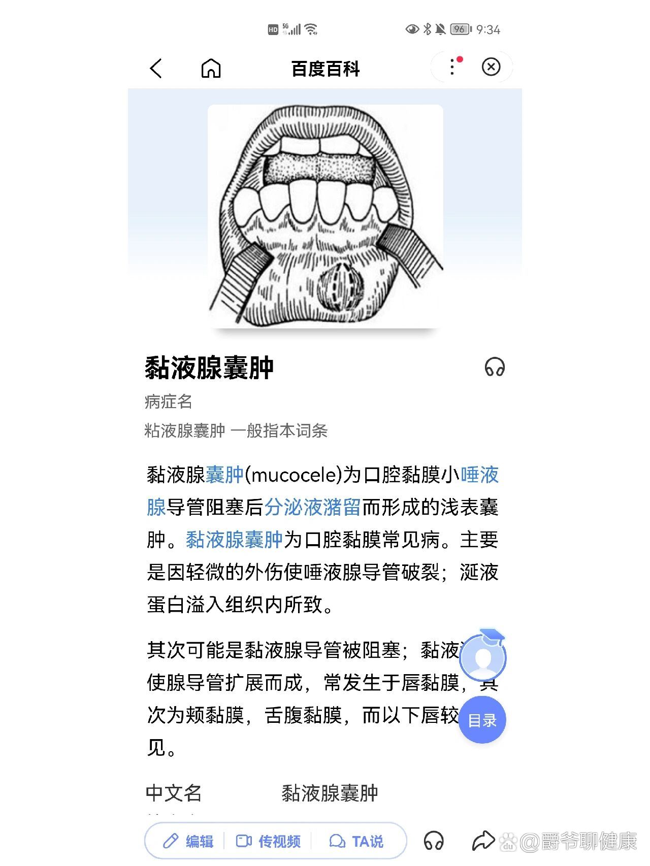 囊肿怎么才能消除掉图片