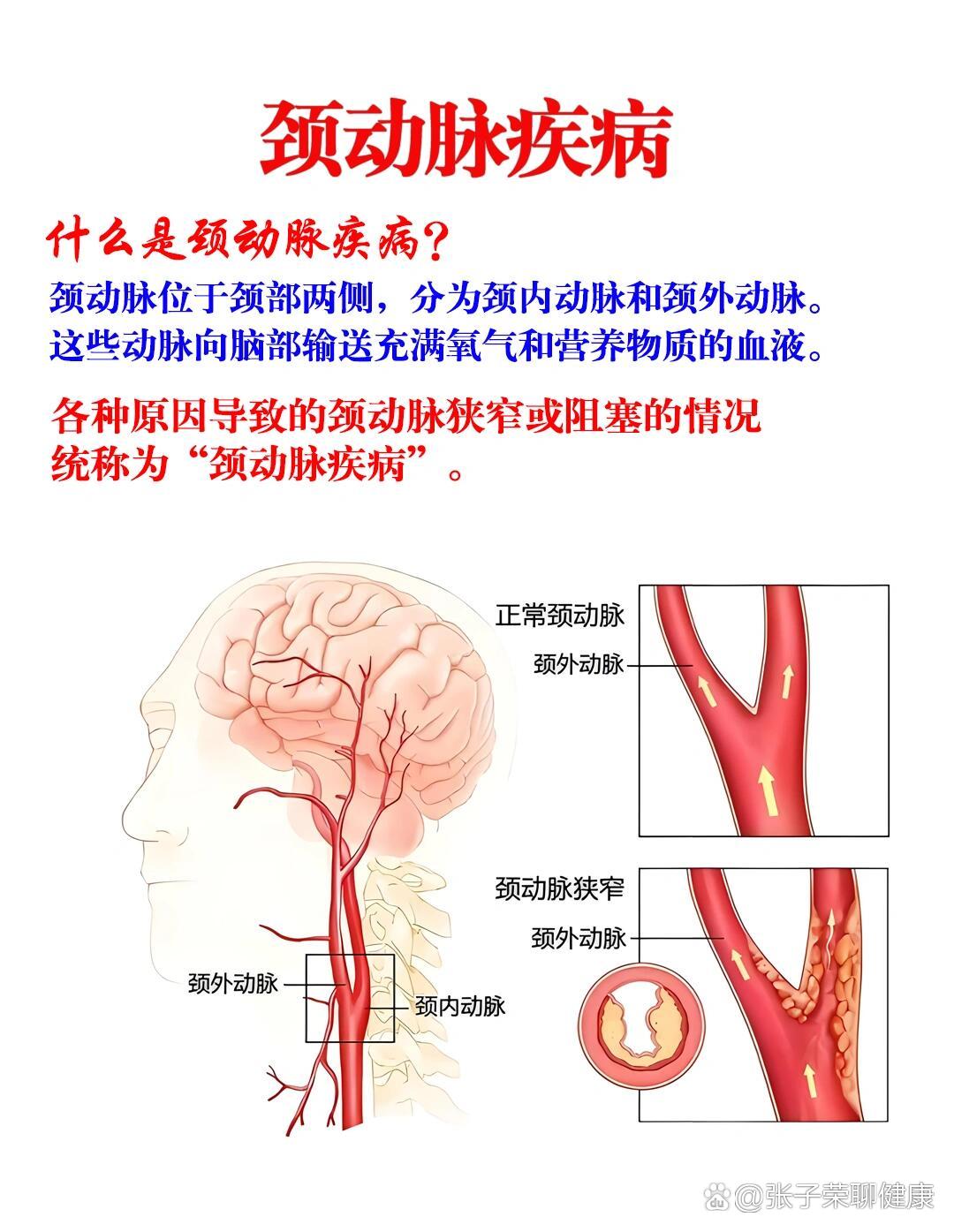 颈外动脉及其分支图图片