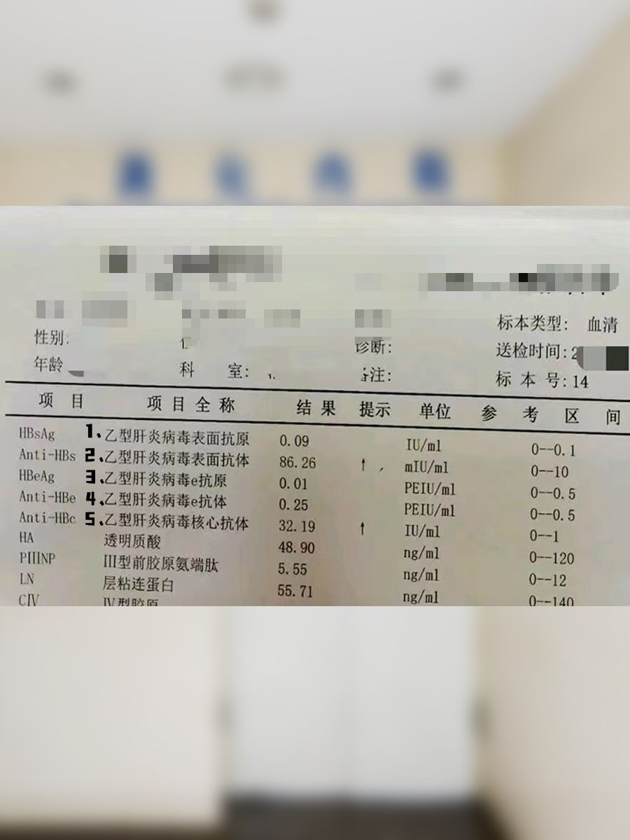 乙肝病毒携带者中的小二阳想转阴?咋办?