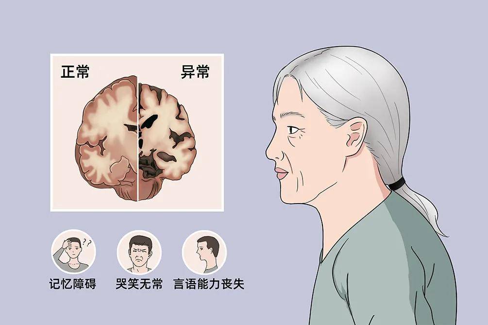 大脑开始"萎缩",身体一般会出现这4个反应,所以要提前预防