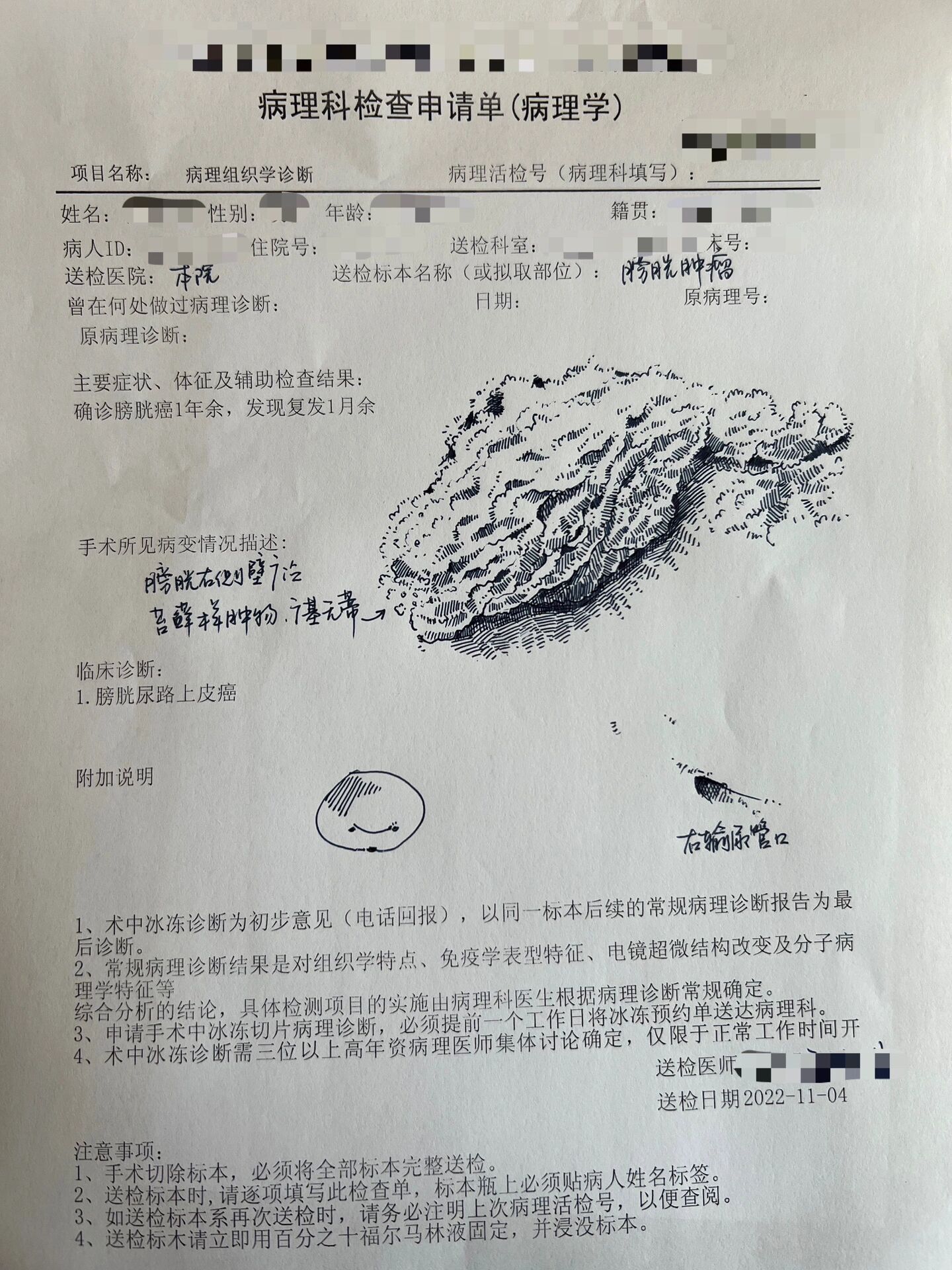 外科医生手绘病理申请单