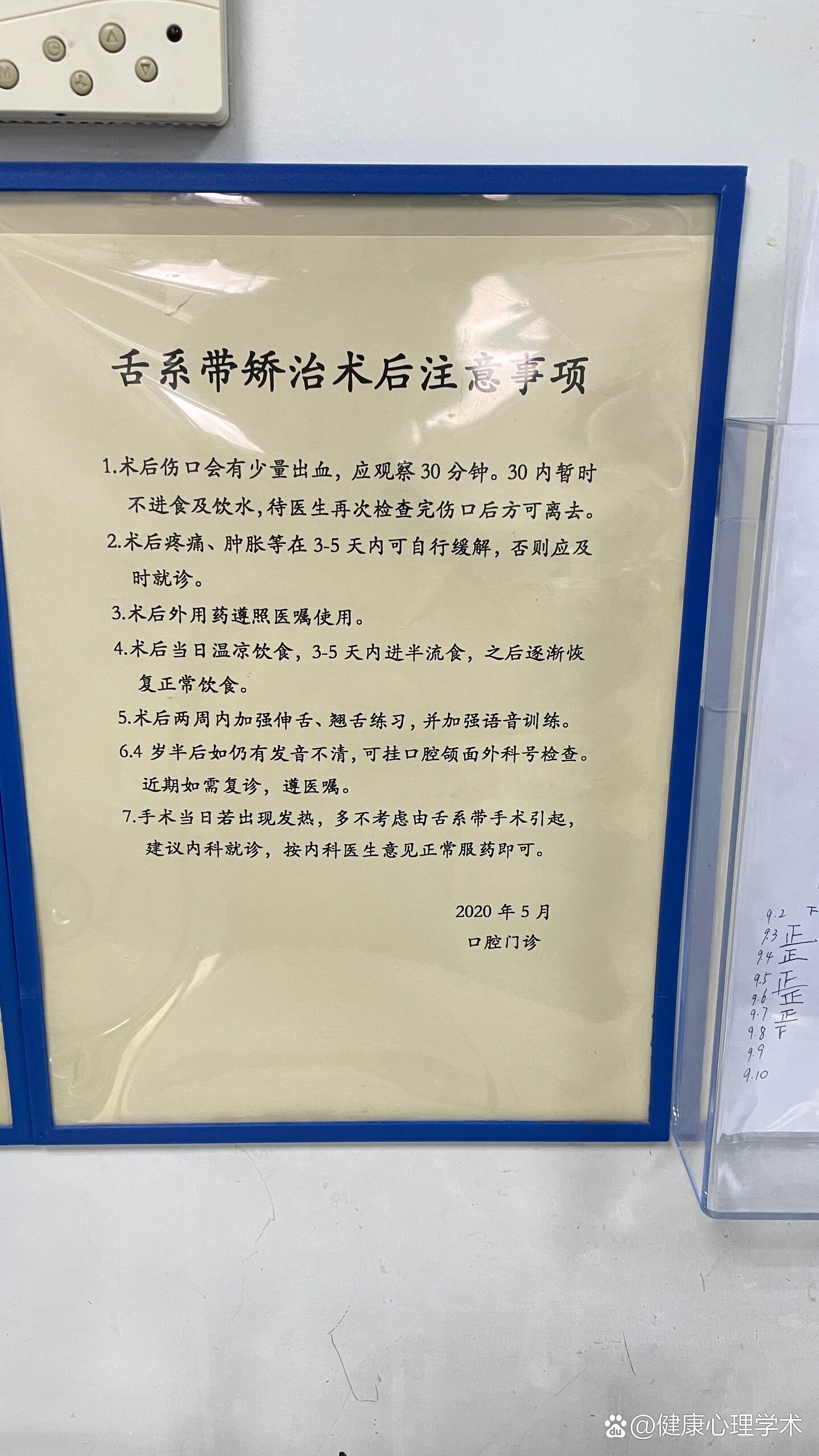 系带延长术动画演示图片