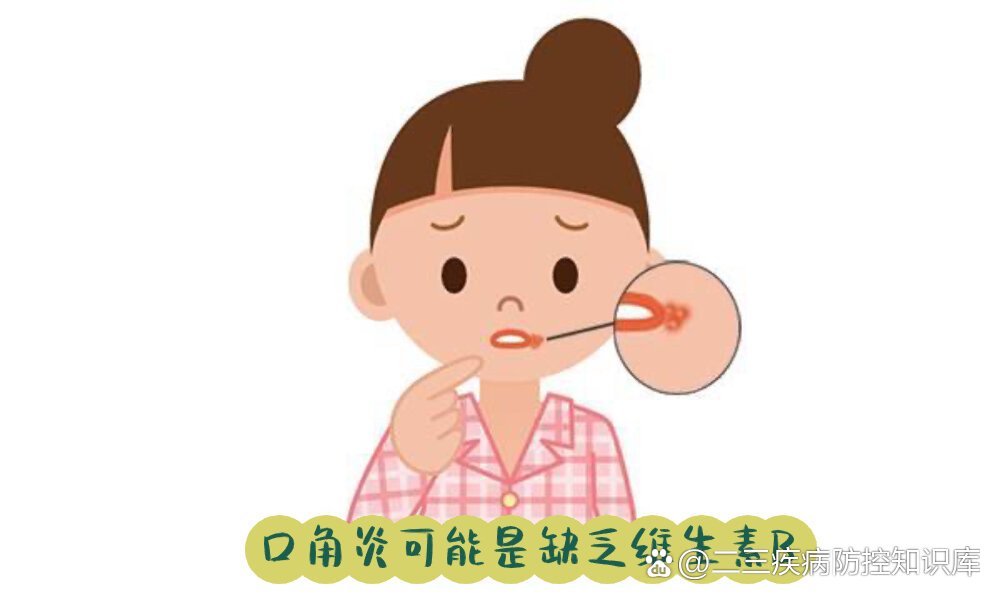 	烂嘴角和上火不太一样口角处会出现红肿