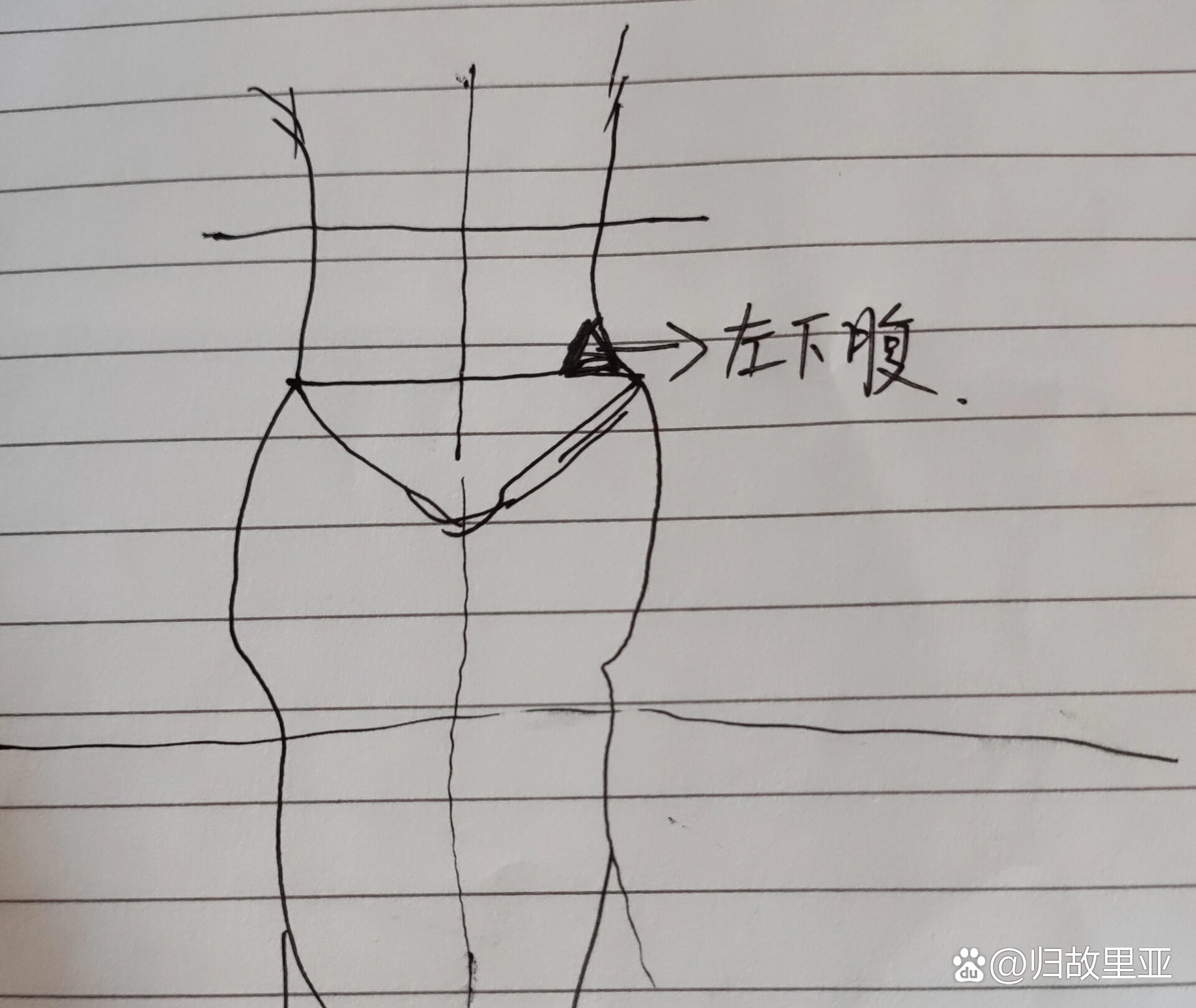 女性左下腹疼痛