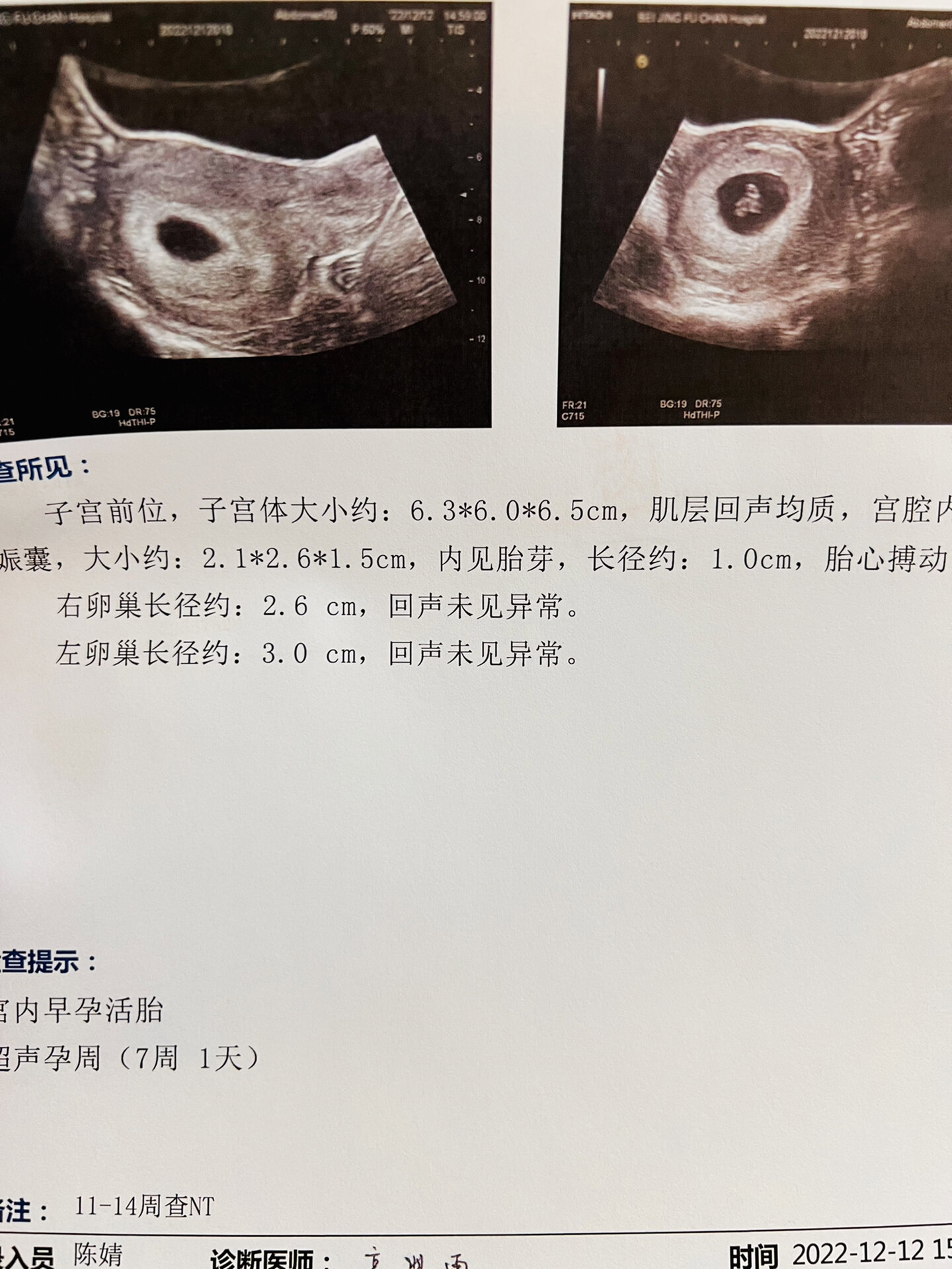 怀孕第七周胎儿发育_怀孕第七周胎儿发育成熟了吗