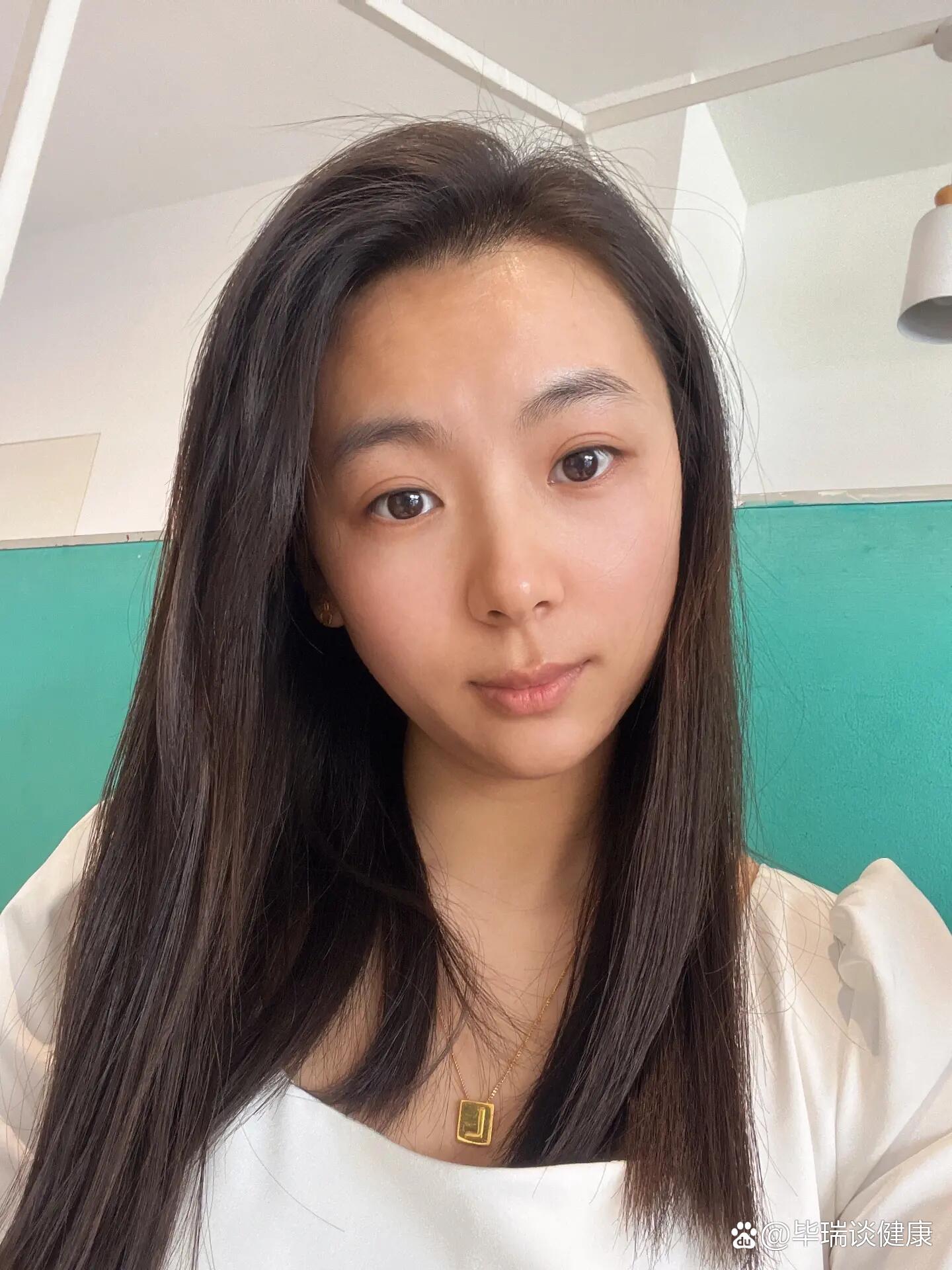 前两张是没有打肉毒素的素颜照片,笑起来弯弯的月牙眼,自我感觉真