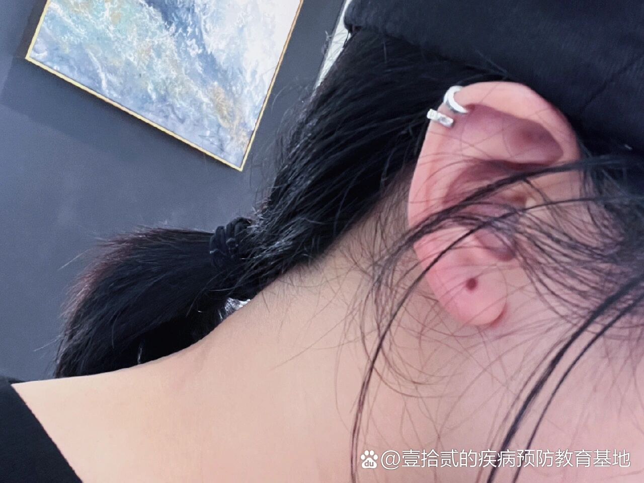 5mm的扩耳器摘下来的耳洞好可爱!