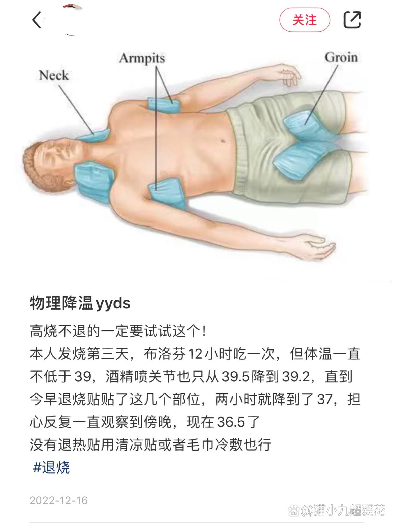 发热冰敷的正确位置图