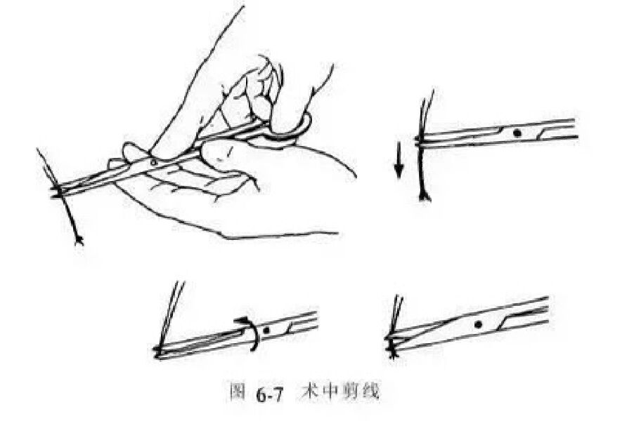 外科打结技能详解(图文并茂)4