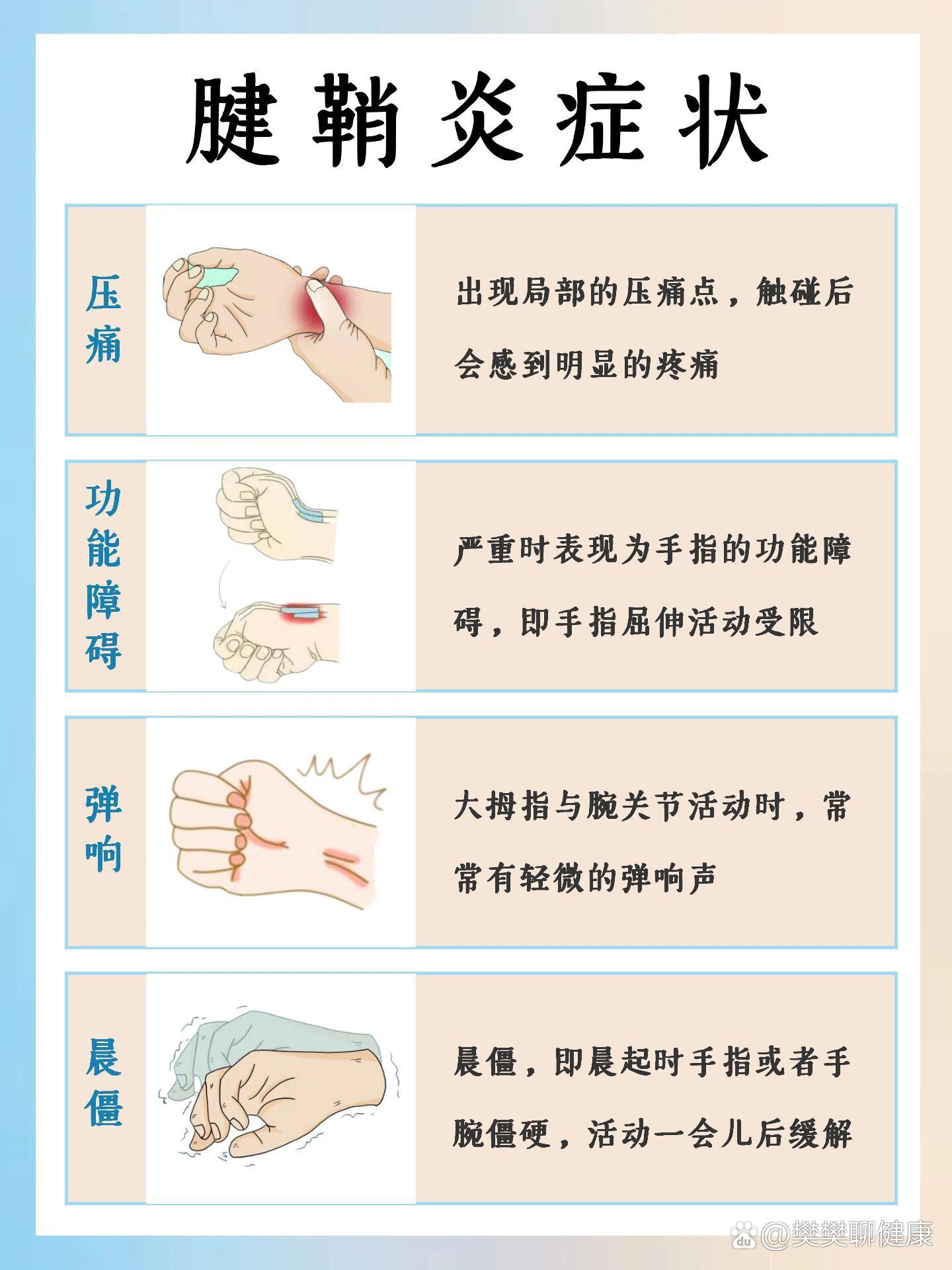 手掌腱鞘炎症状图片图片