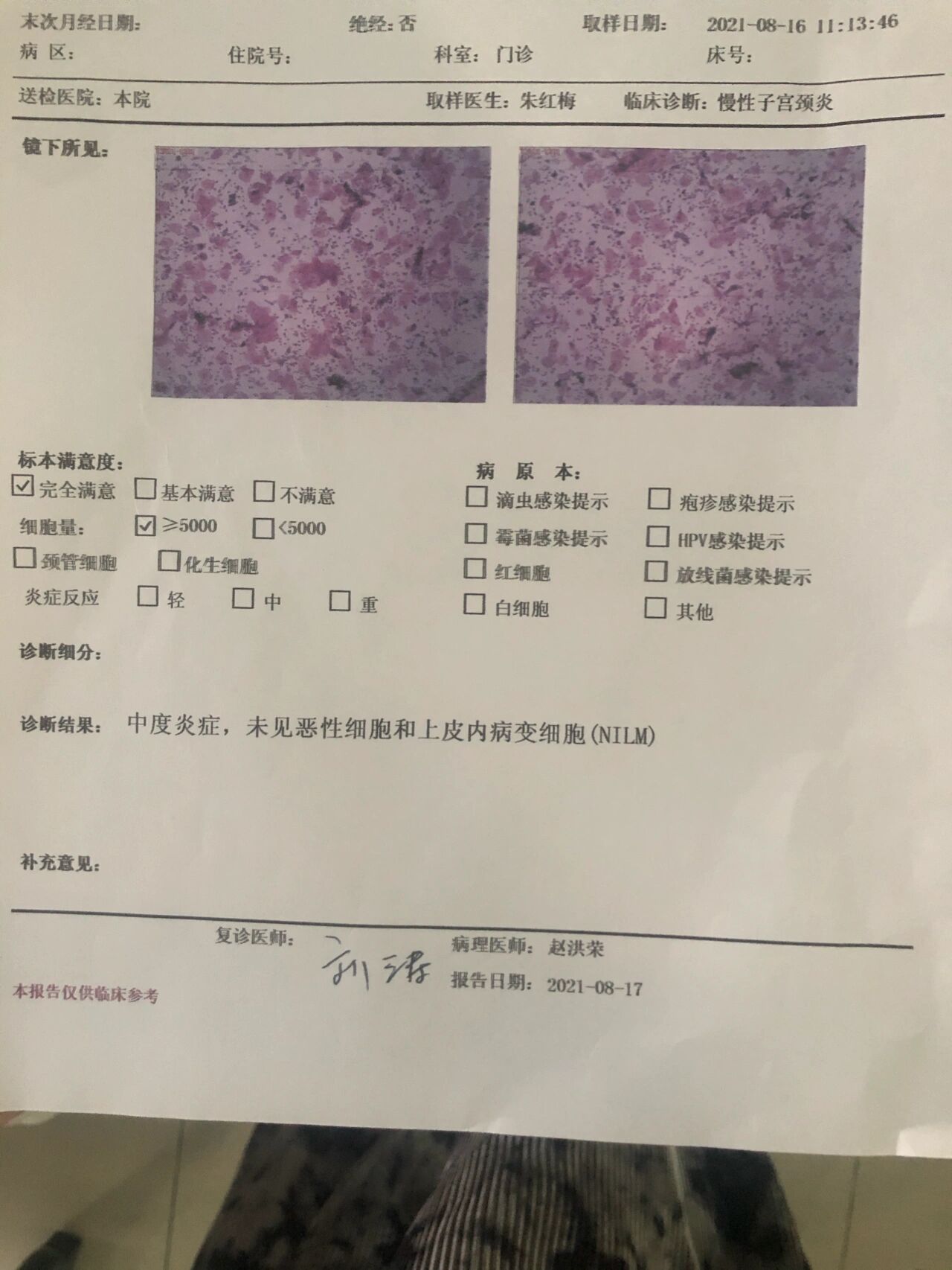 新鲜出炉的宫颈癌筛查报告